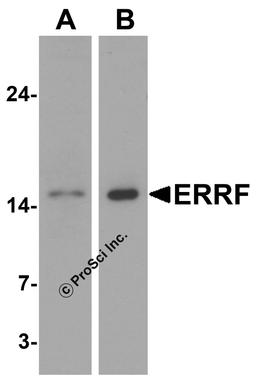 Western blot analysis of ERRF in (A) HeLa and (B) A-20 cell lysate with ERRF antibody at 1 μg/mL.