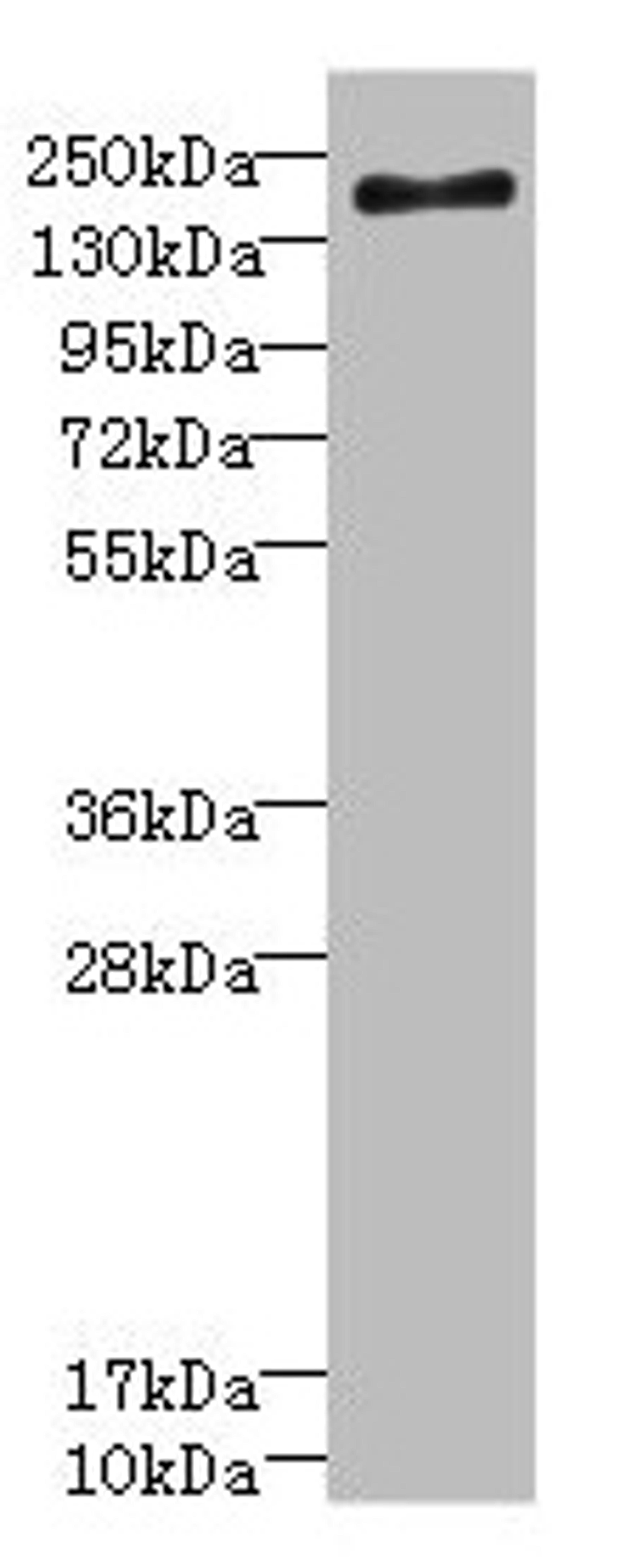 Western blot. All lanes: SCN7A antibody at 2.36µg/ml + Jurkat whole cell lysate. Secondary. Goat polyclonal to rabbit IgG at 1/10000 dilution. Predicted band size: 194 kDa. Observed band size: 194 kDa