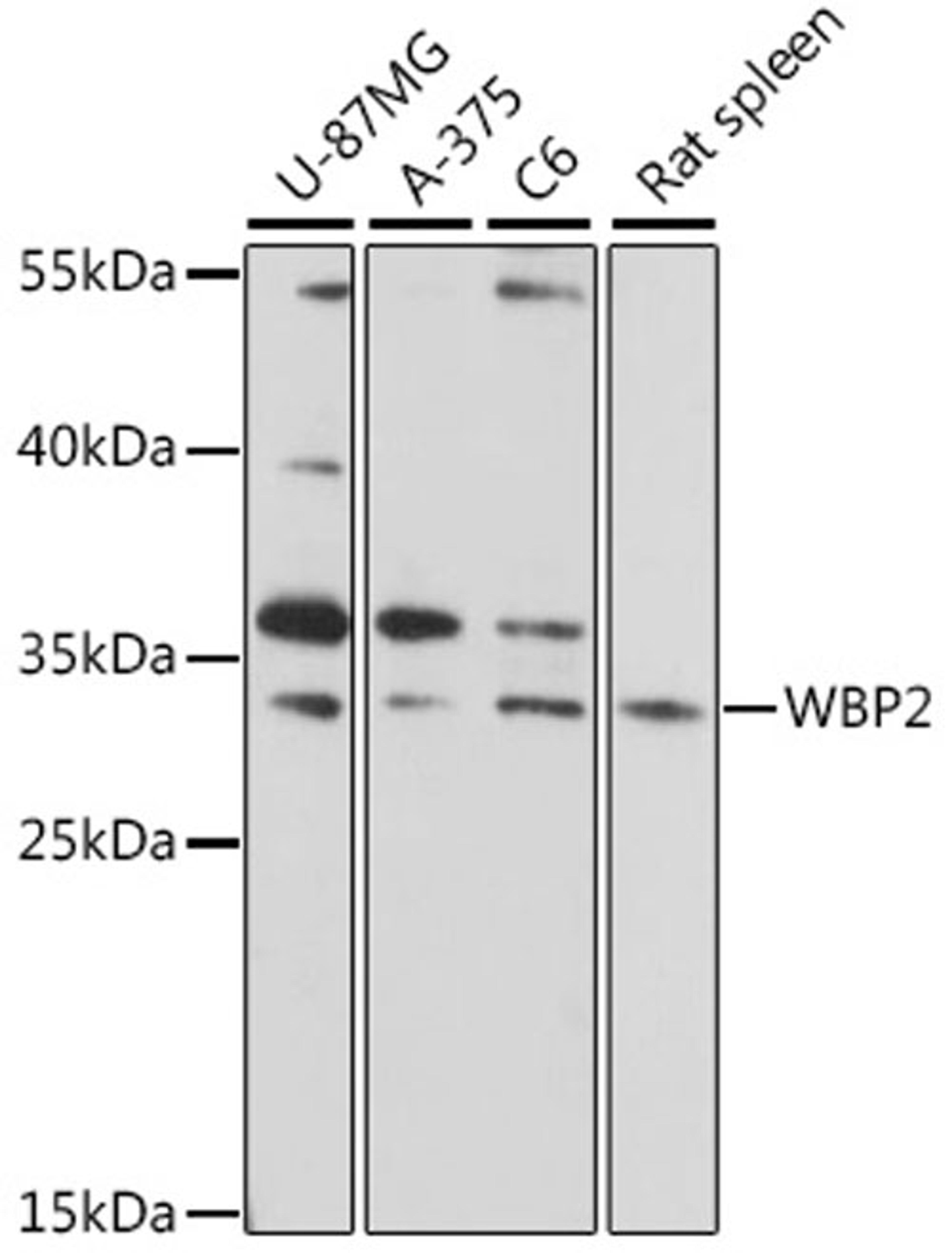 Western blot - WBP2 antibody (A16312)