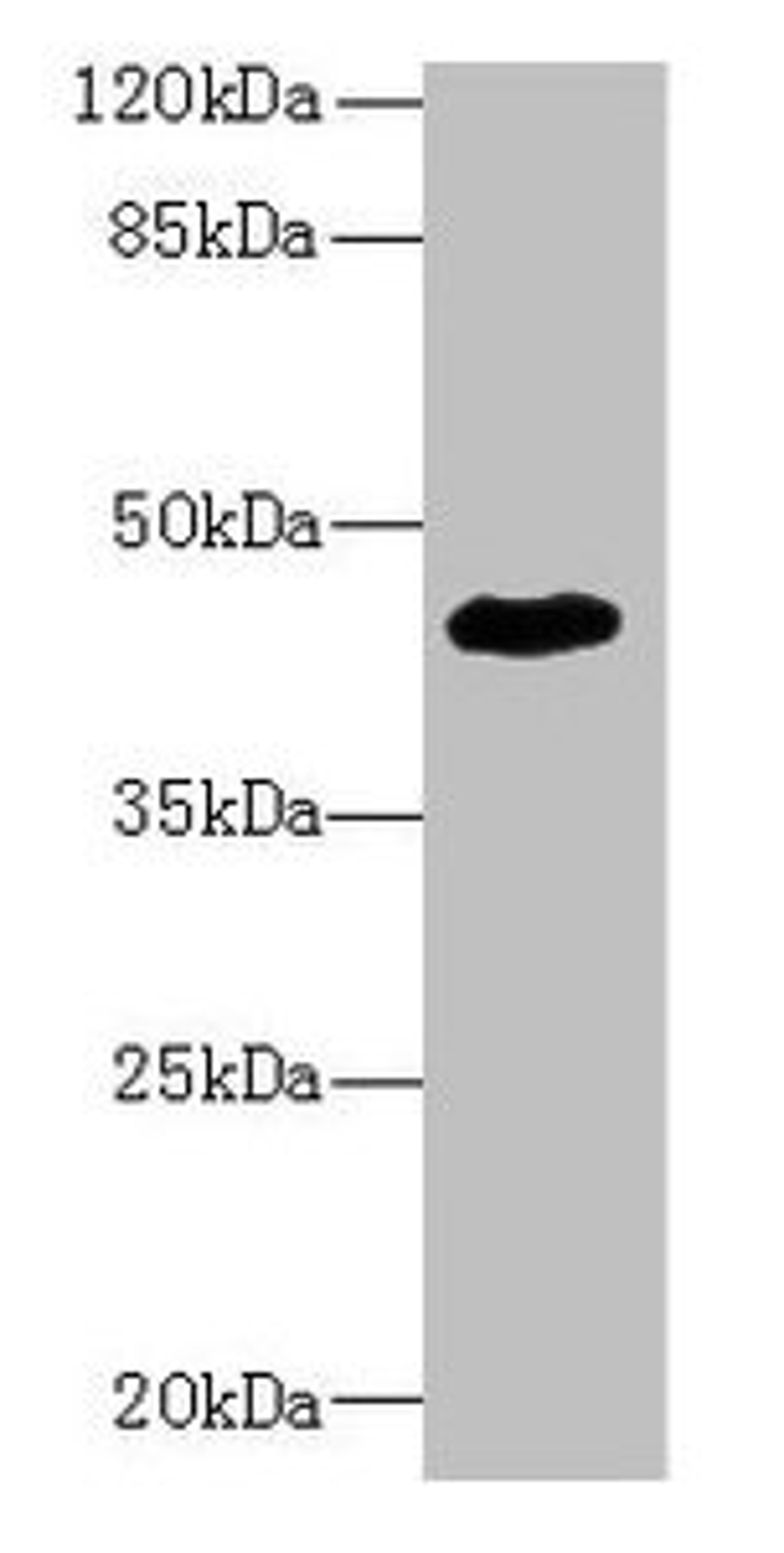 Western blot. All lanes: ZNF670 antibody at 5µg/ml + HepG2 whole cell lysate. Secondary. Goat polyclonal to rabbit IgG at 1/10000 dilution. Predicted band size: 45 kDa. Observed band size: 45 kDa