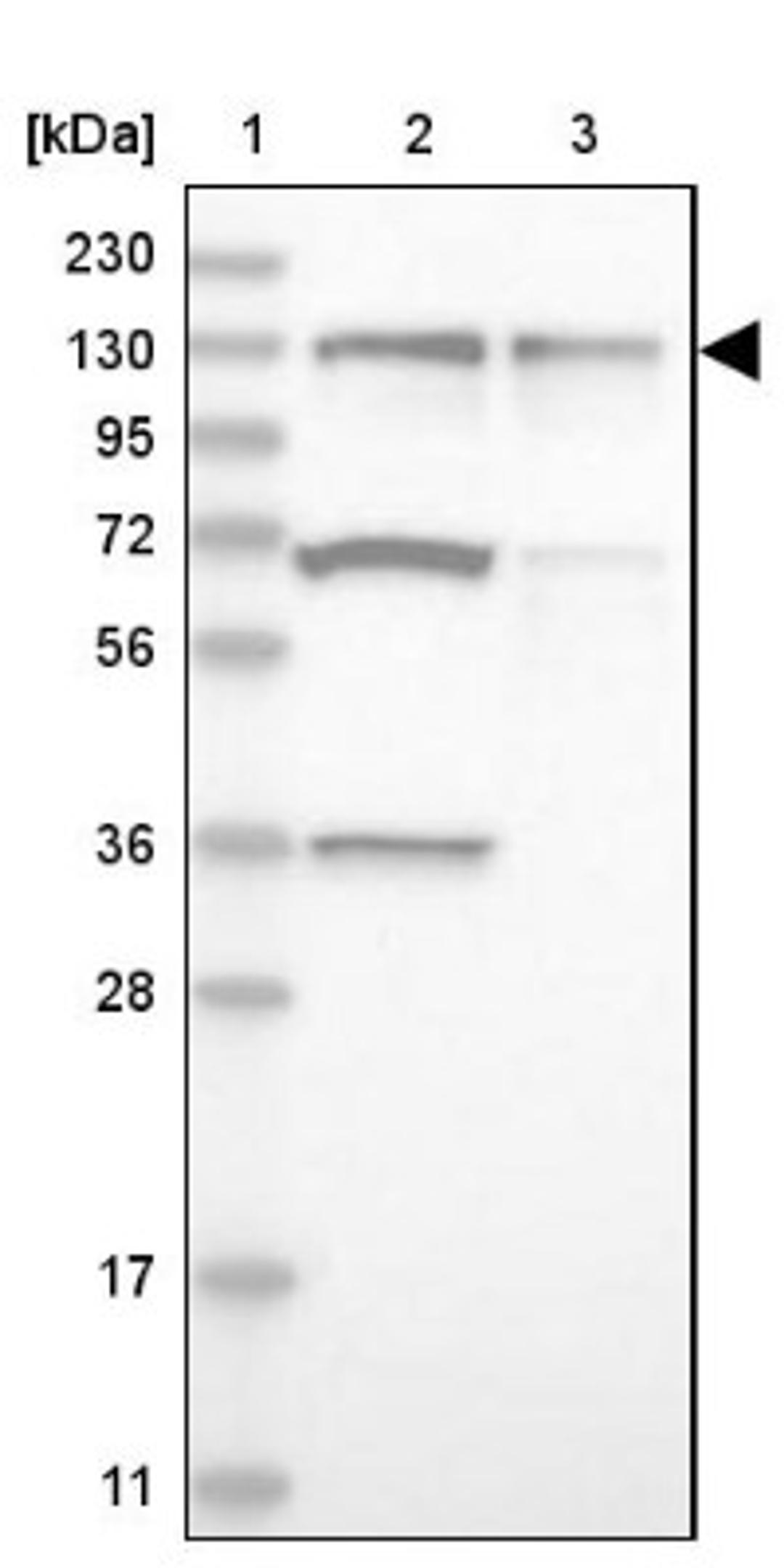 Western Blot: ZNF280D Antibody [NBP1-82207] - Lane 1: Marker [kDa] 230, 130, 95, 72, 56, 36, 28, 17, 11<br/>Lane 2: Human cell line RT-4<br/>Lane 3: Human cell line U-251MG sp