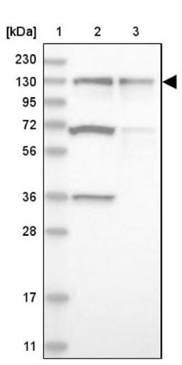 Western Blot: ZNF280D Antibody [NBP1-82207] - Lane 1: Marker [kDa] 230, 130, 95, 72, 56, 36, 28, 17, 11<br/>Lane 2: Human cell line RT-4<br/>Lane 3: Human cell line U-251MG sp