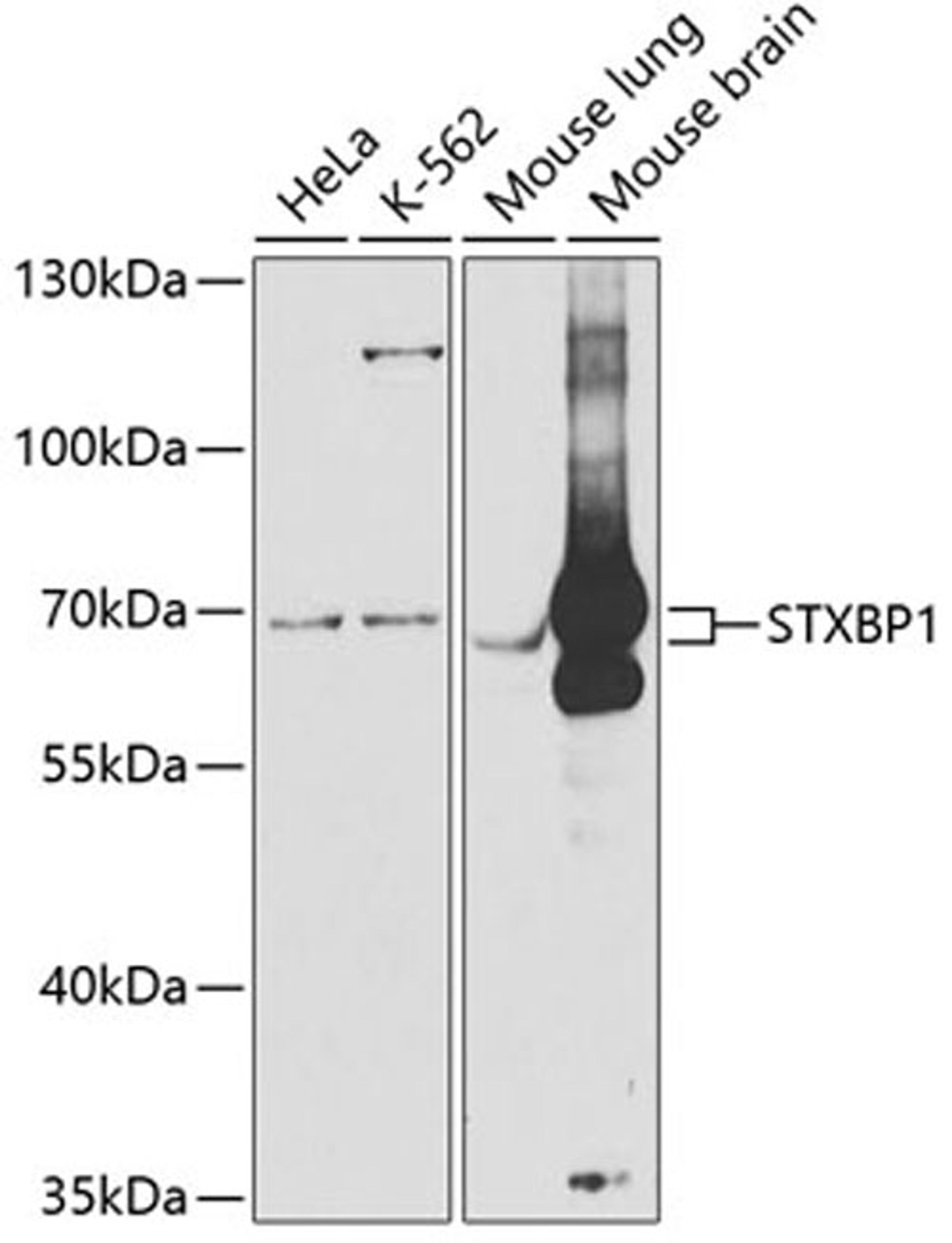 Western blot - STXBP1 antibody (A5420)