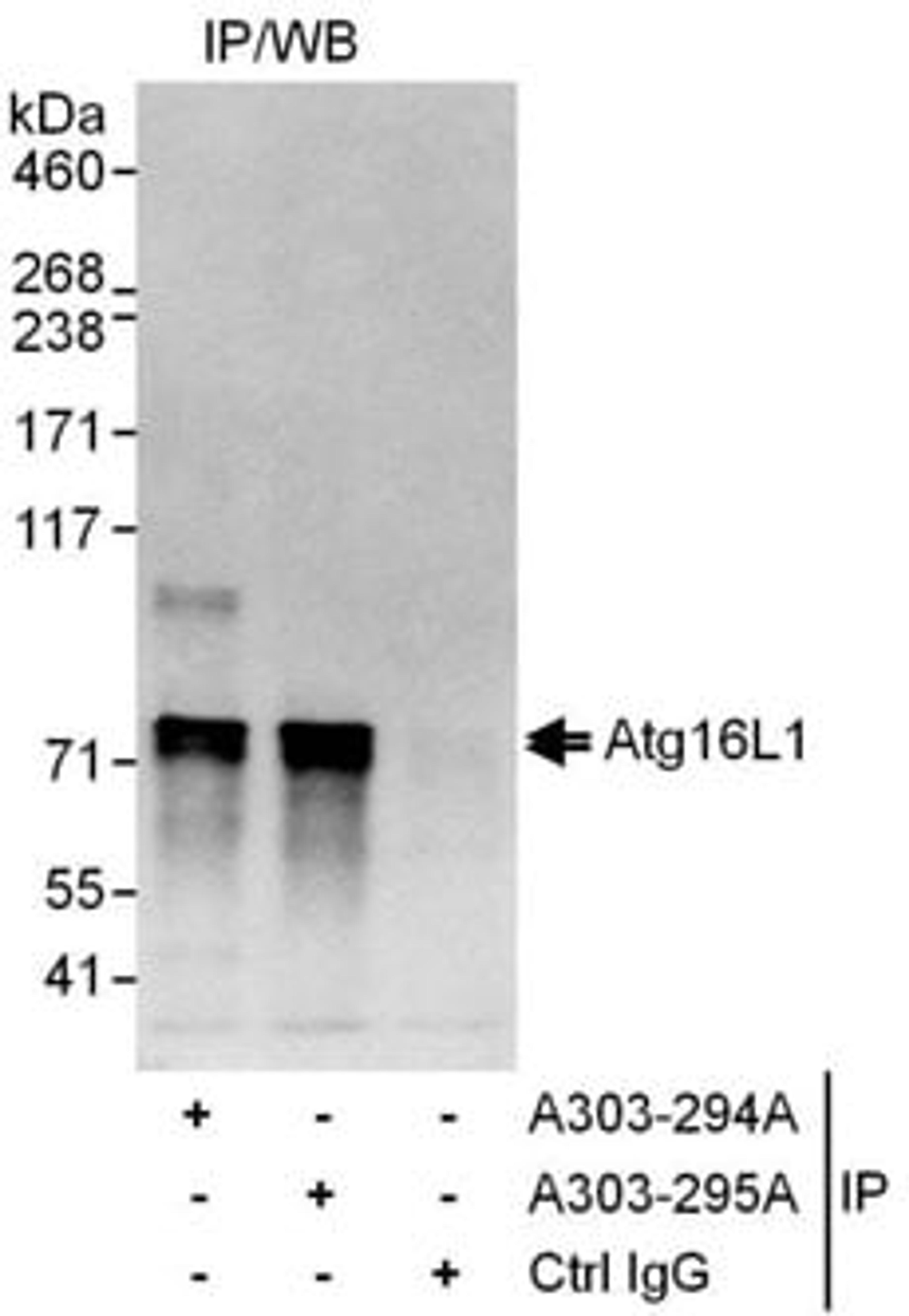 Detection of human Atg16L1 by western blot of immunoprecipitates.