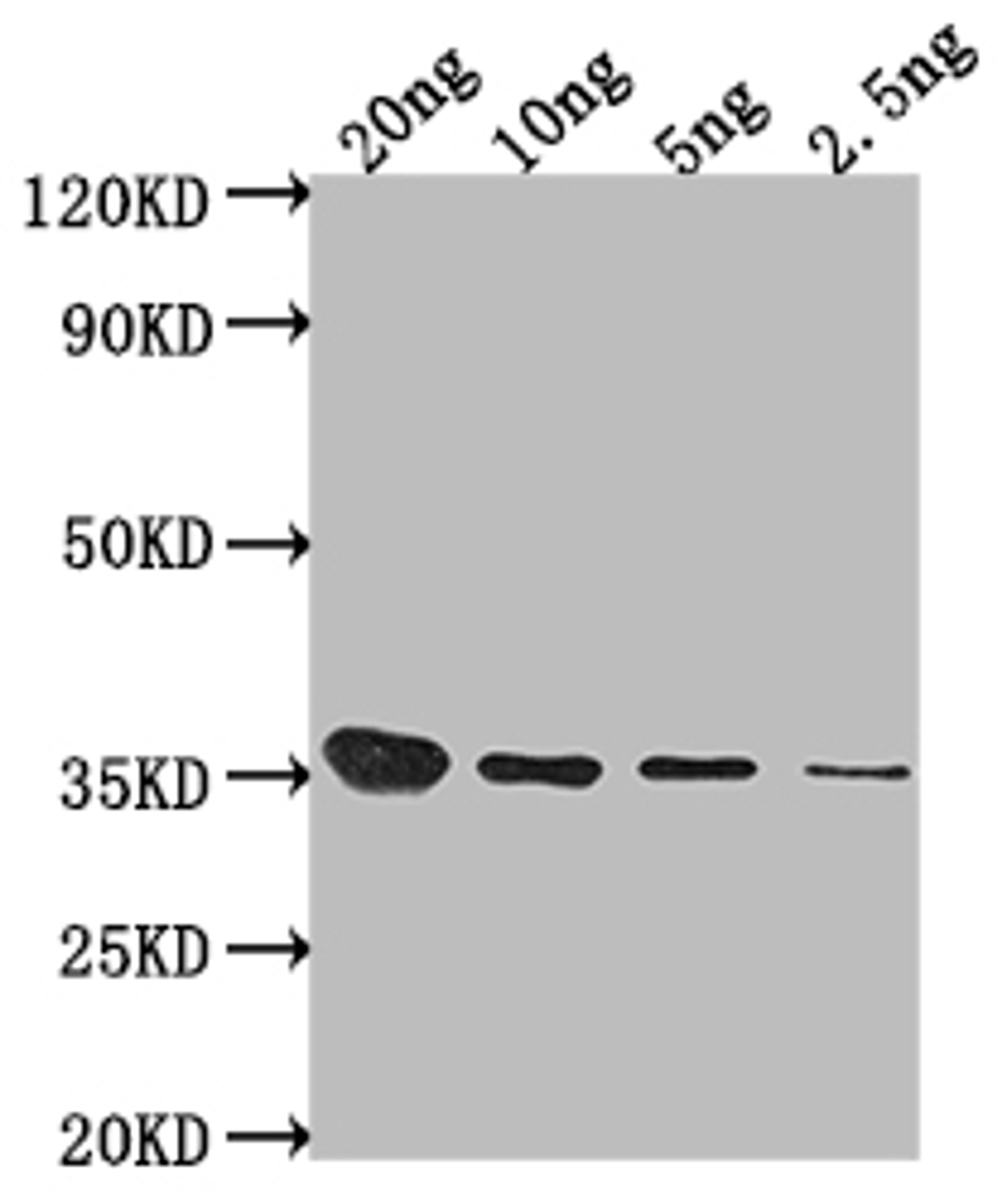 Western Blot. Positive WB detected in Recombinant protein. All lanes: Sbk1 antibody at 1:2000. Secondary. Goat polyclonal to rabbit IgG at 1/50000 dilution. Predicted band size: 34.4 kDa. Observed band size: 35 kDa.