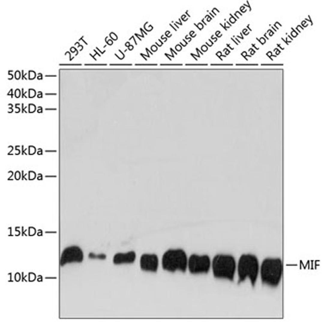 Western blot - MIF Rabbit mAb (A11231)