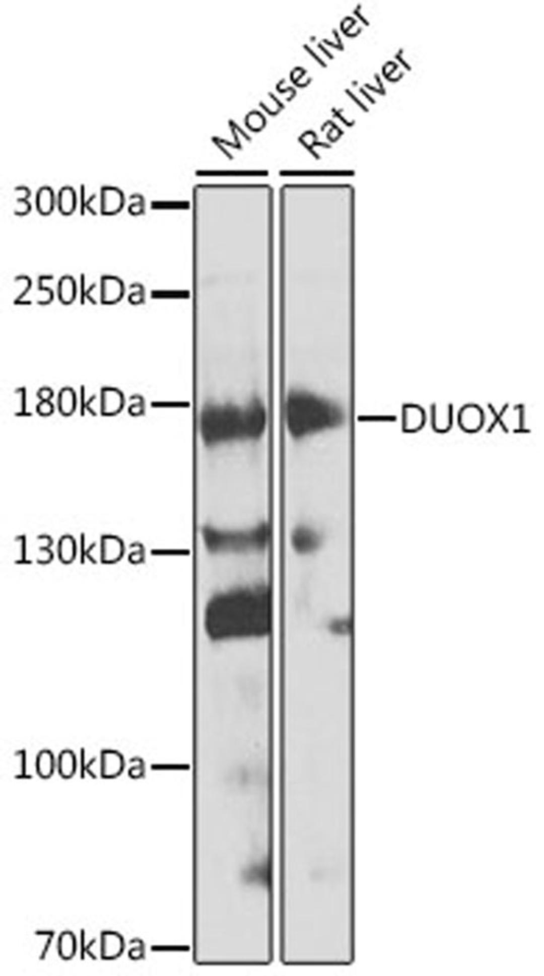 Western blot - DUOX1 antibody (A8583)