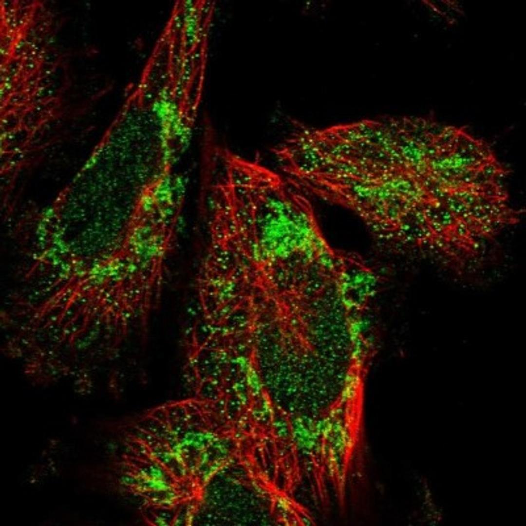 Immunocytochemistry/Immunofluorescence: C19orf52 Antibody [NBP1-94151] - Staining of human cell line U-251 MG shows positivity in nucleus but not nucleoli & mitochondria.