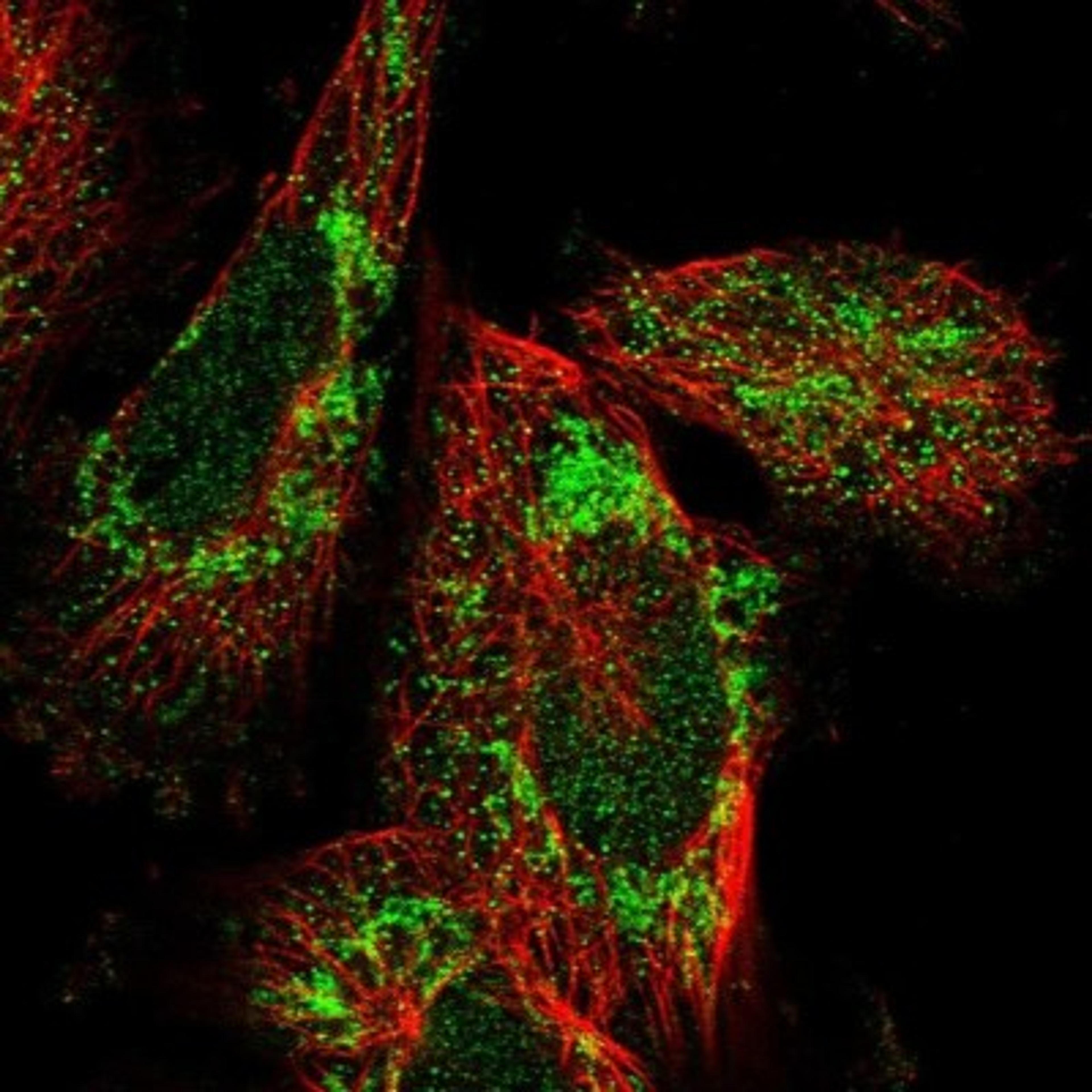 Immunocytochemistry/Immunofluorescence: C19orf52 Antibody [NBP1-94151] - Staining of human cell line U-251 MG shows positivity in nucleus but not nucleoli & mitochondria.