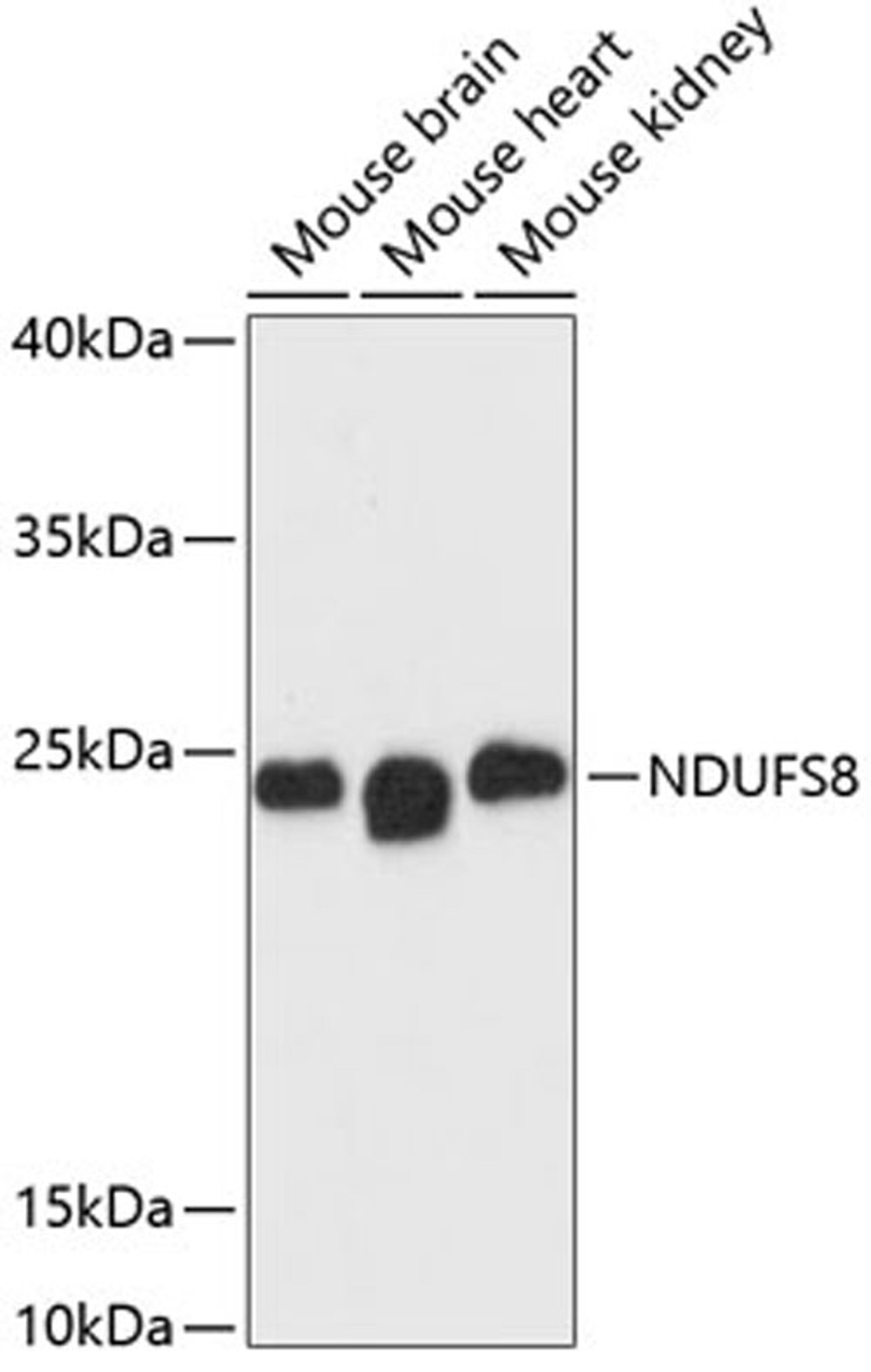 Western blot - NDUFS8 antibody (A13034)