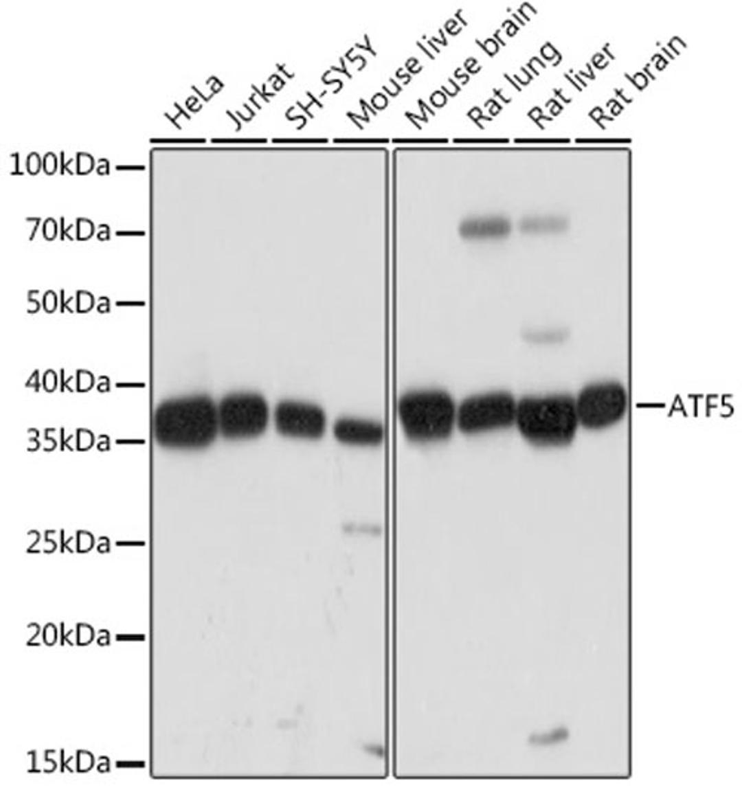 Western blot - ATF5 Rabbit mAb (A3563)