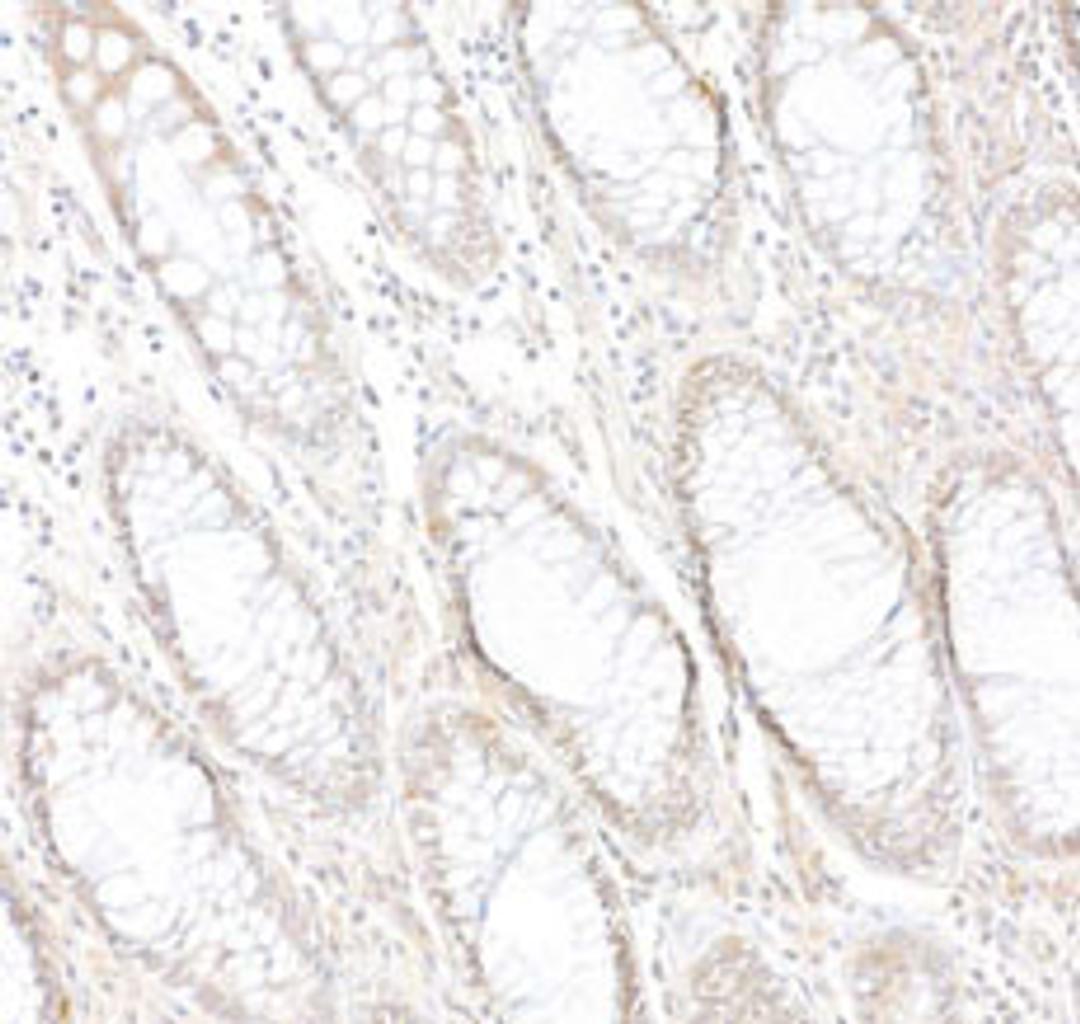 Detection of human PARP10 by immunohistochemistry. 