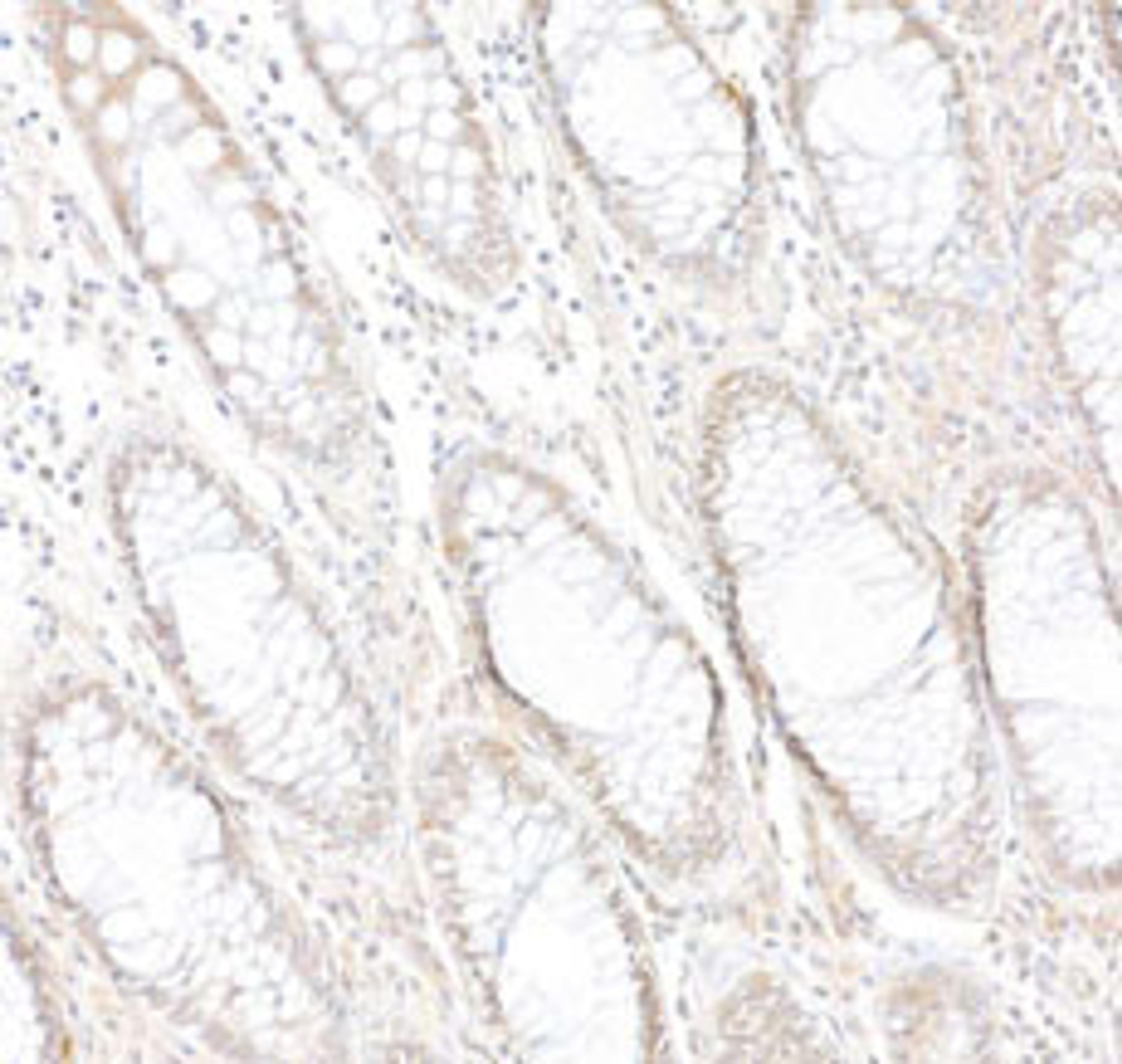 Detection of human PARP10 by immunohistochemistry. 