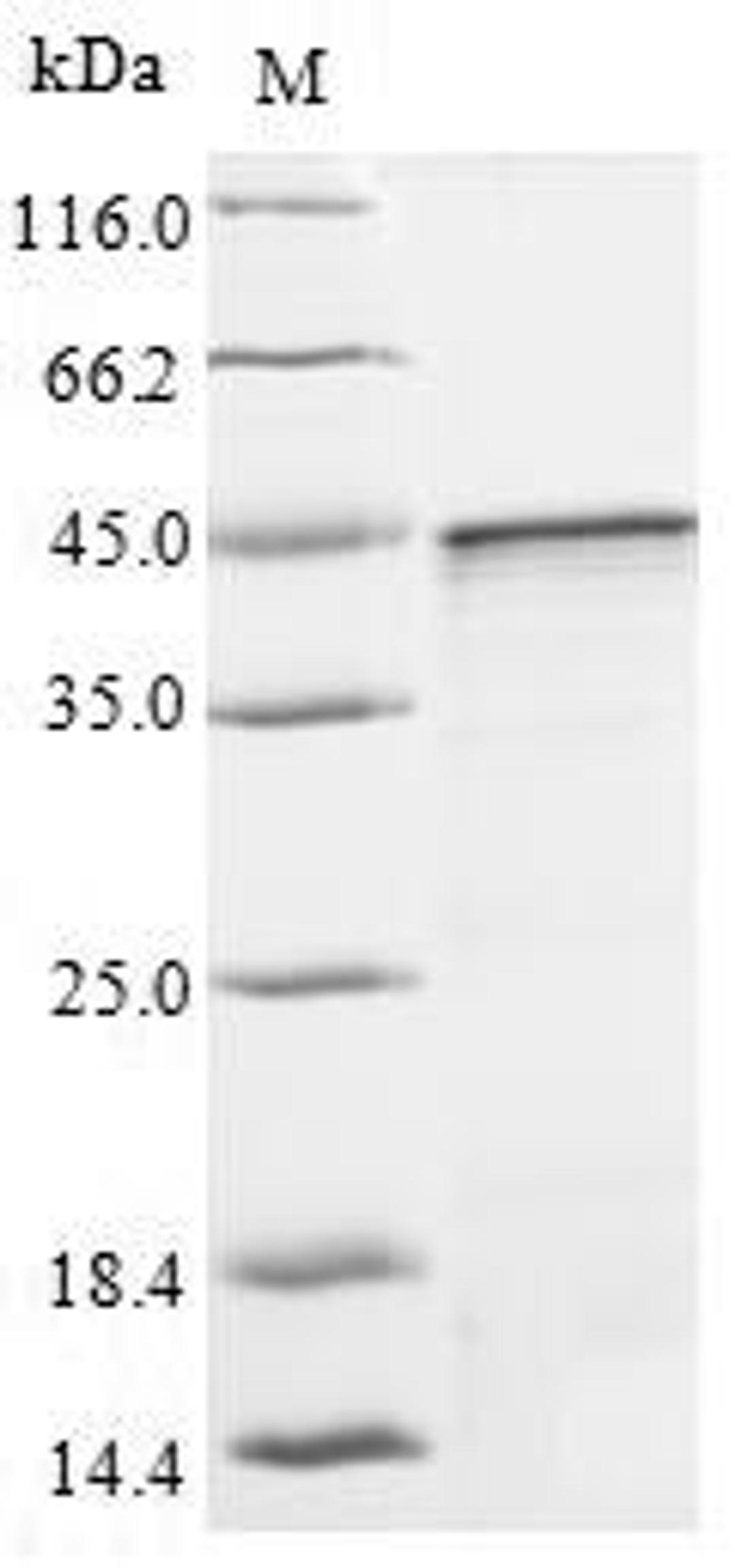 (Tris-Glycine gel) Discontinuous SDS-PAGE (reduced) with 5% enrichment gel and 15% separation gel.