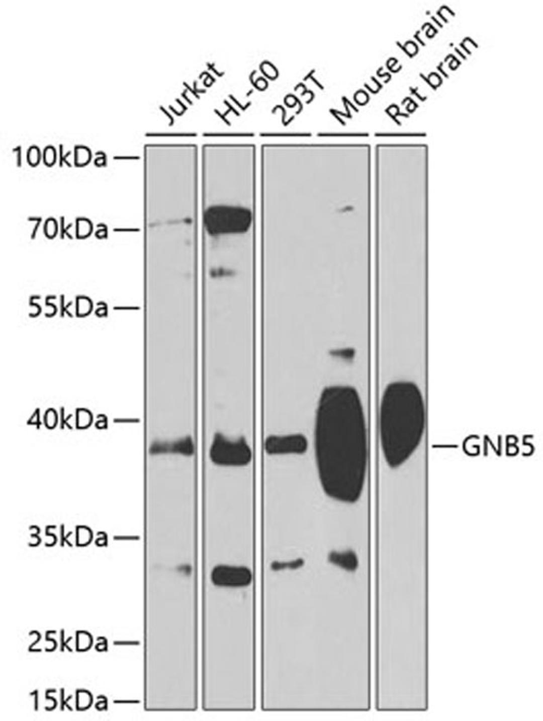 Western blot - GNB5 antibody (A4447)