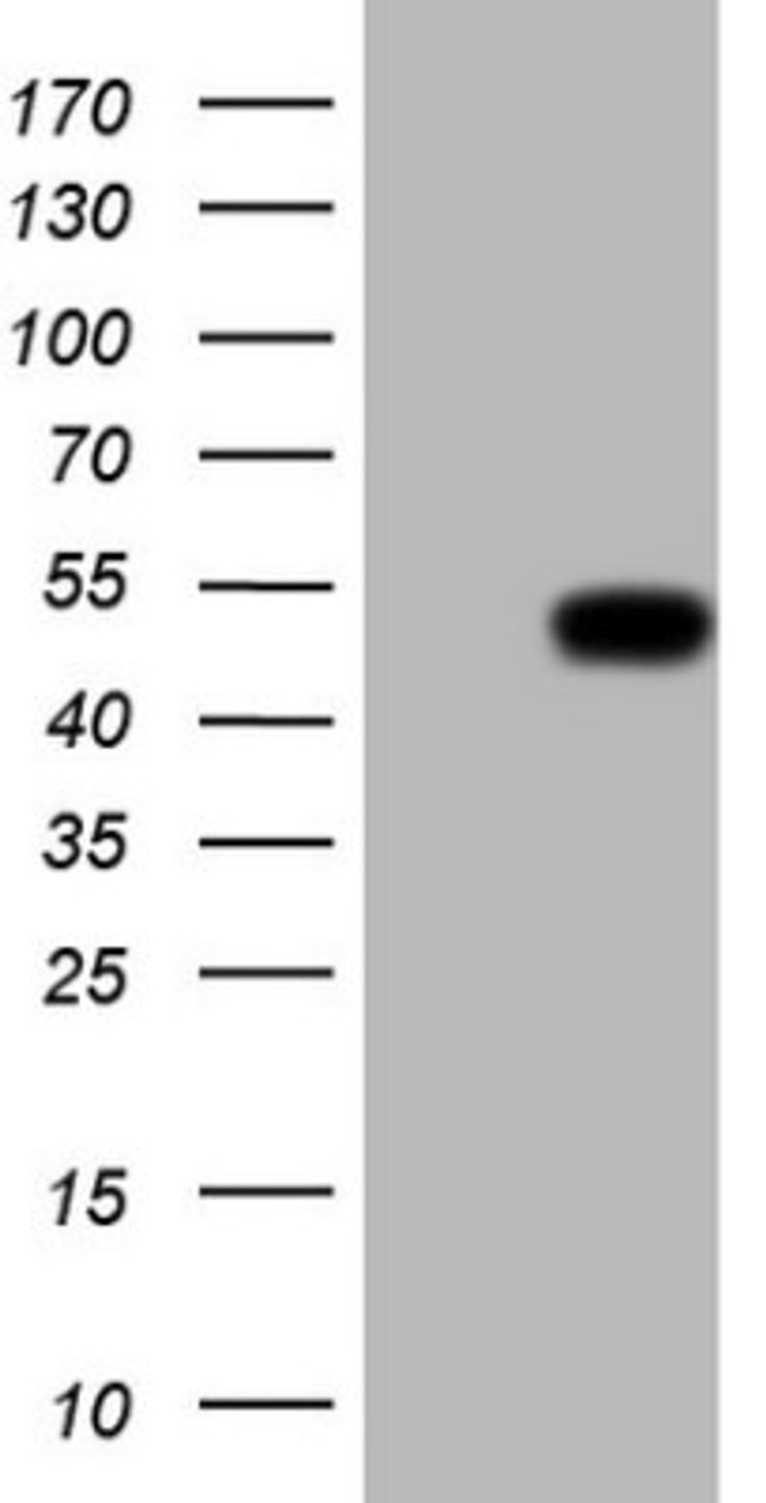 Western Blot: Renin Antibody (2F10) [NBP2-45552] - Analysis of HEK293T cells were transfected with the pCMV6-ENTRY control (Left lane) or pCMV6-ENTRY Renin.