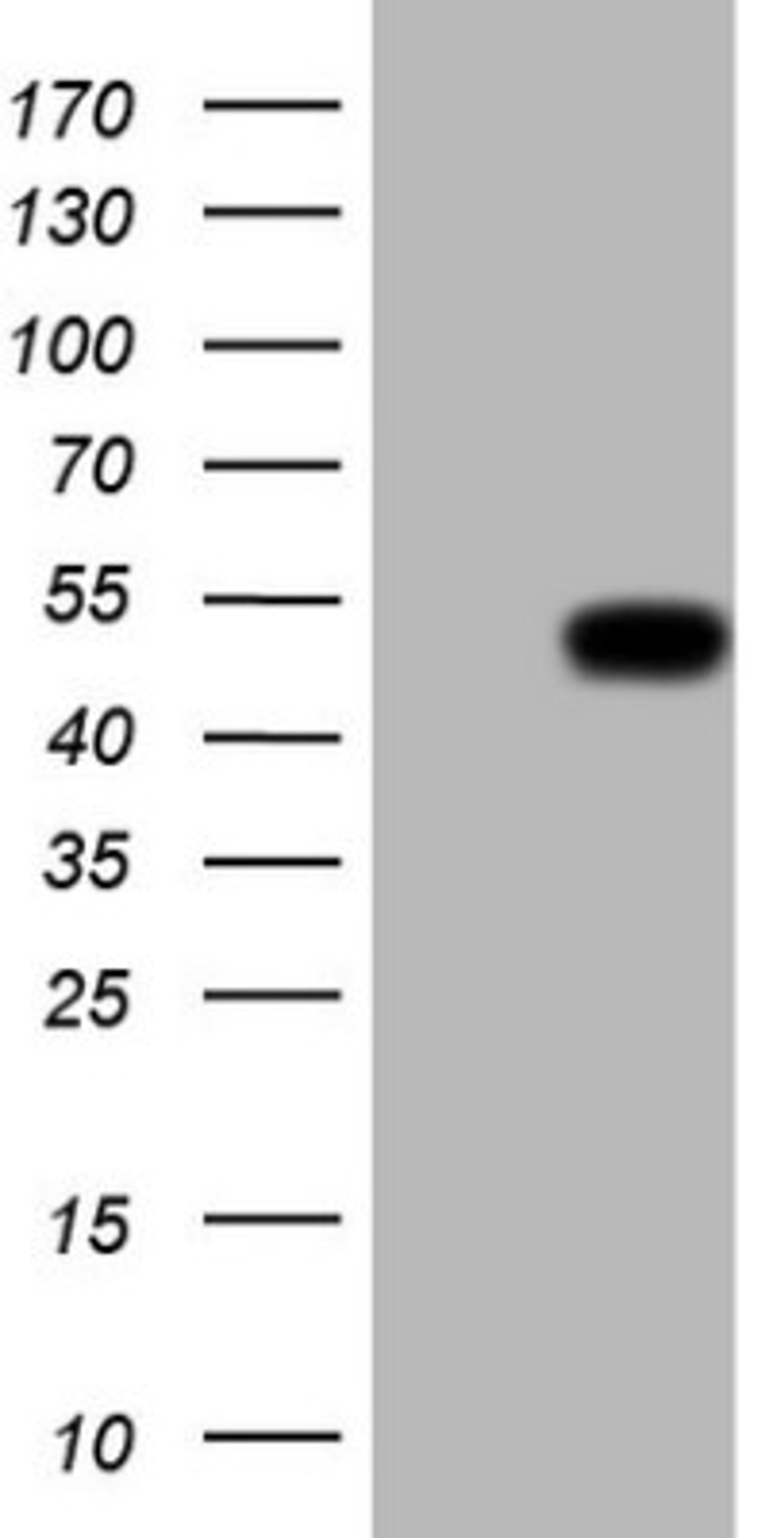 Western Blot: Renin Antibody (2F10) [NBP2-45552] - Analysis of HEK293T cells were transfected with the pCMV6-ENTRY control (Left lane) or pCMV6-ENTRY Renin.