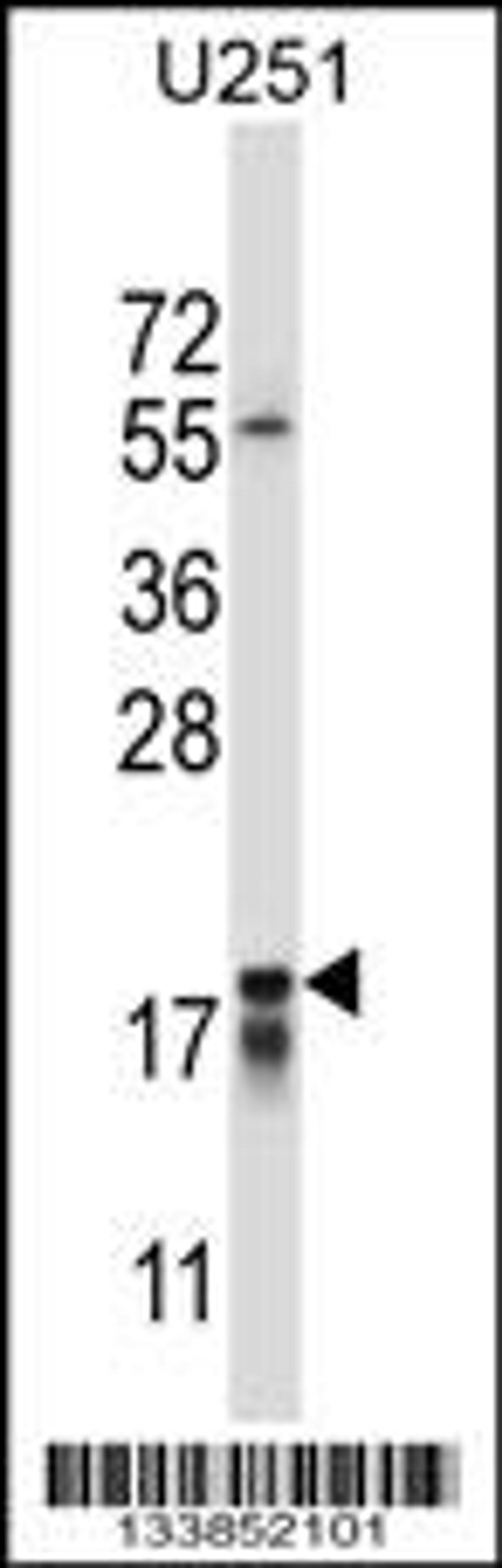 Western blot analysis in U251 cell line lysates (35ug/lane).