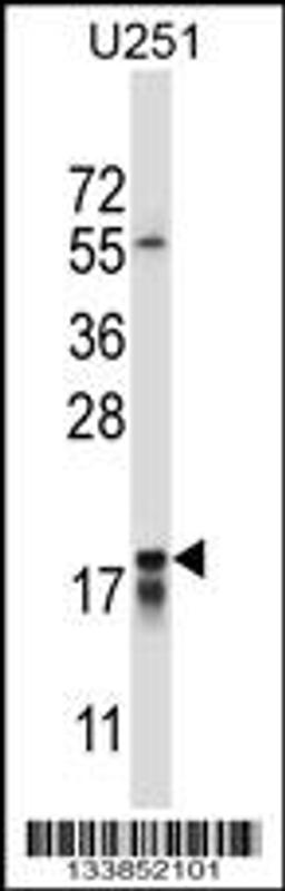 Western blot analysis in U251 cell line lysates (35ug/lane).