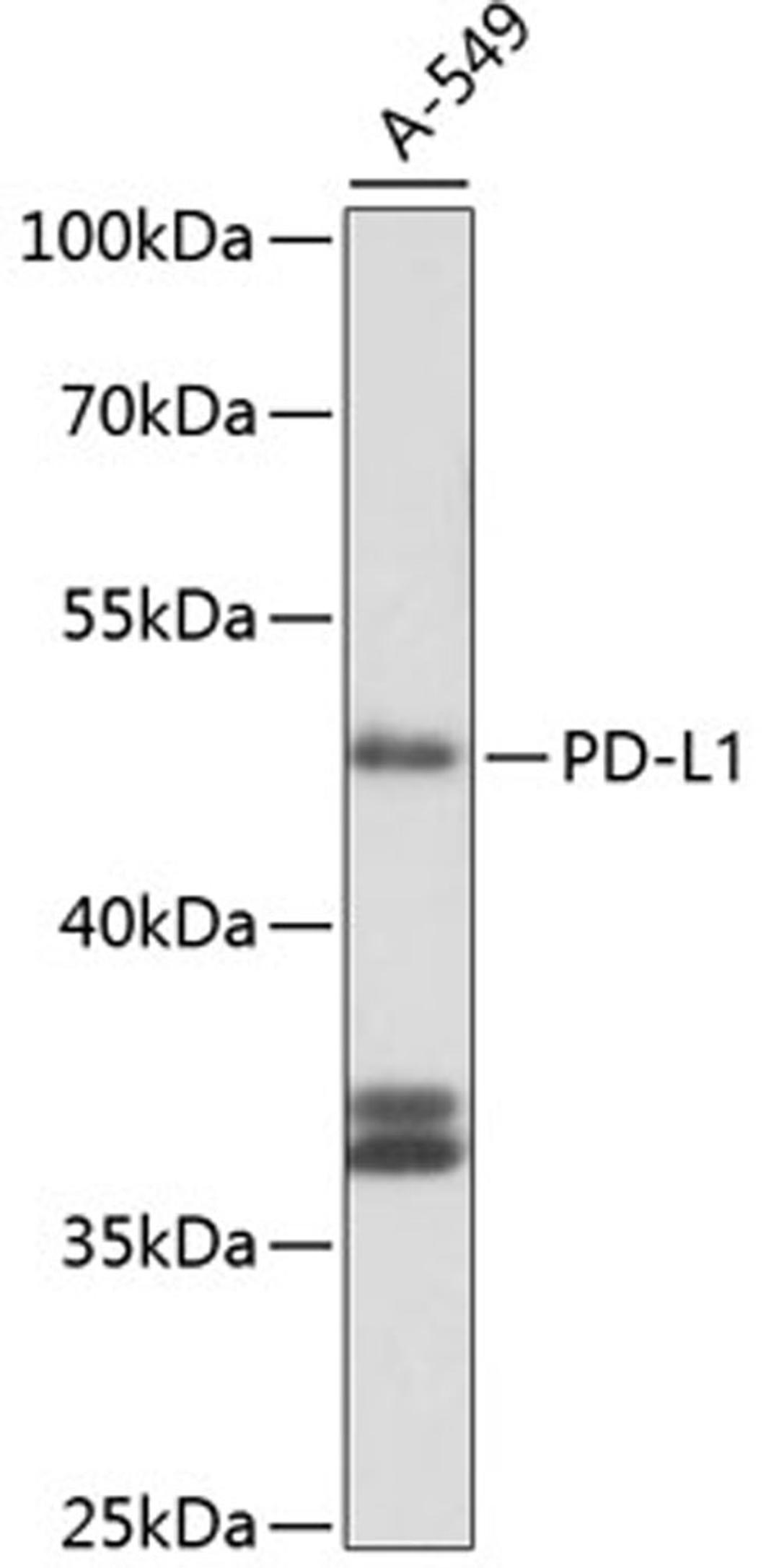 Western blot - PD-L1 antibody (A11273)