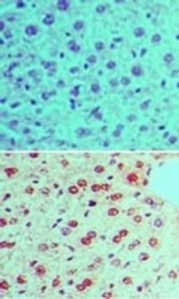 Immunohistochemistry-Paraffin: Rad17 [p Ser645] Antibody [NBP2-24457] - Analysis of phosphorylated Rad17 in formalin-fixed, paraffin-embedded mouse liver tissue using an isotype control (top) and this antibody (bottom) at 5 ug/ml.