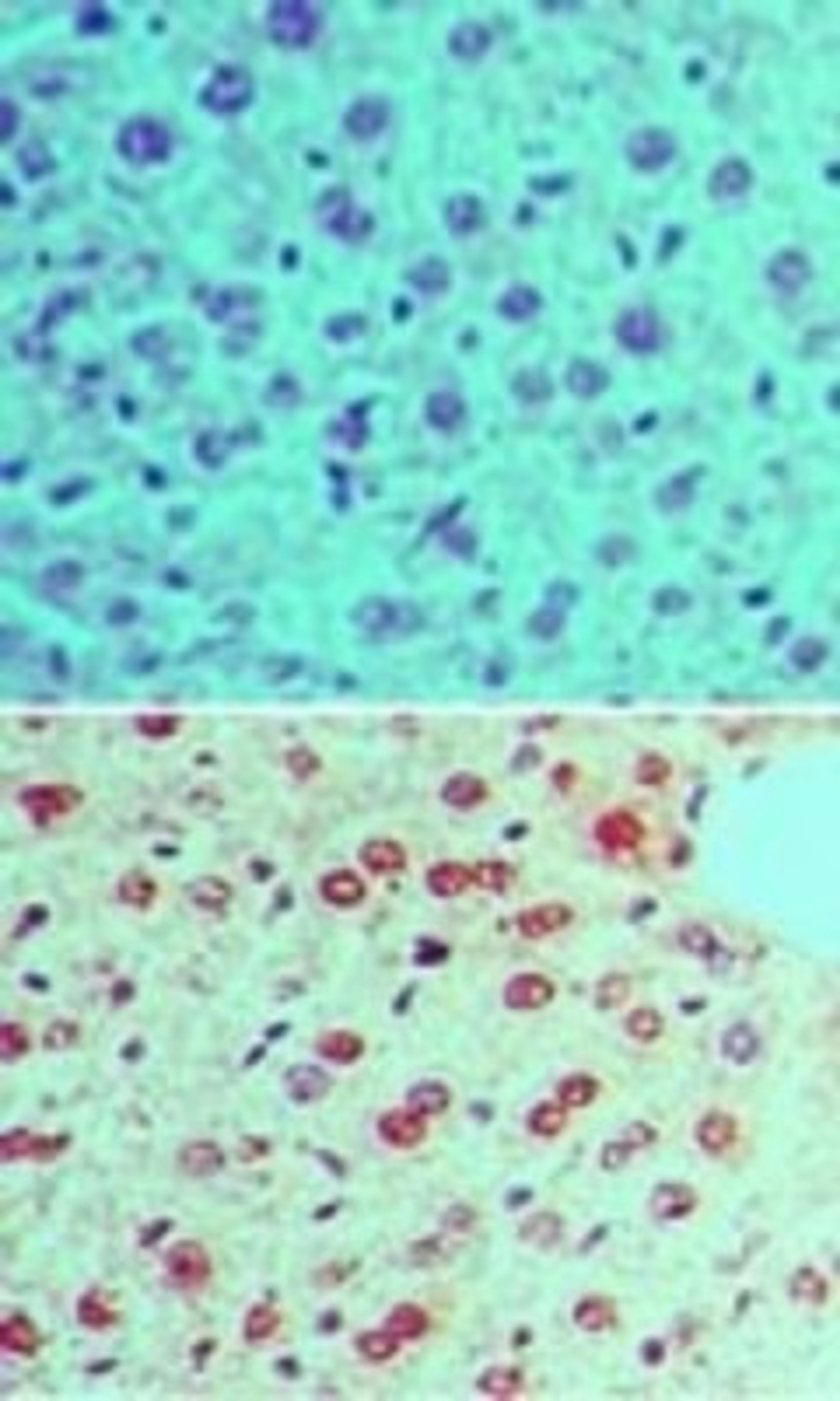 Immunohistochemistry-Paraffin: Rad17 [p Ser645] Antibody [NBP2-24457] - Analysis of phosphorylated Rad17 in formalin-fixed, paraffin-embedded mouse liver tissue using an isotype control (top) and this antibody (bottom) at 5 ug/ml.