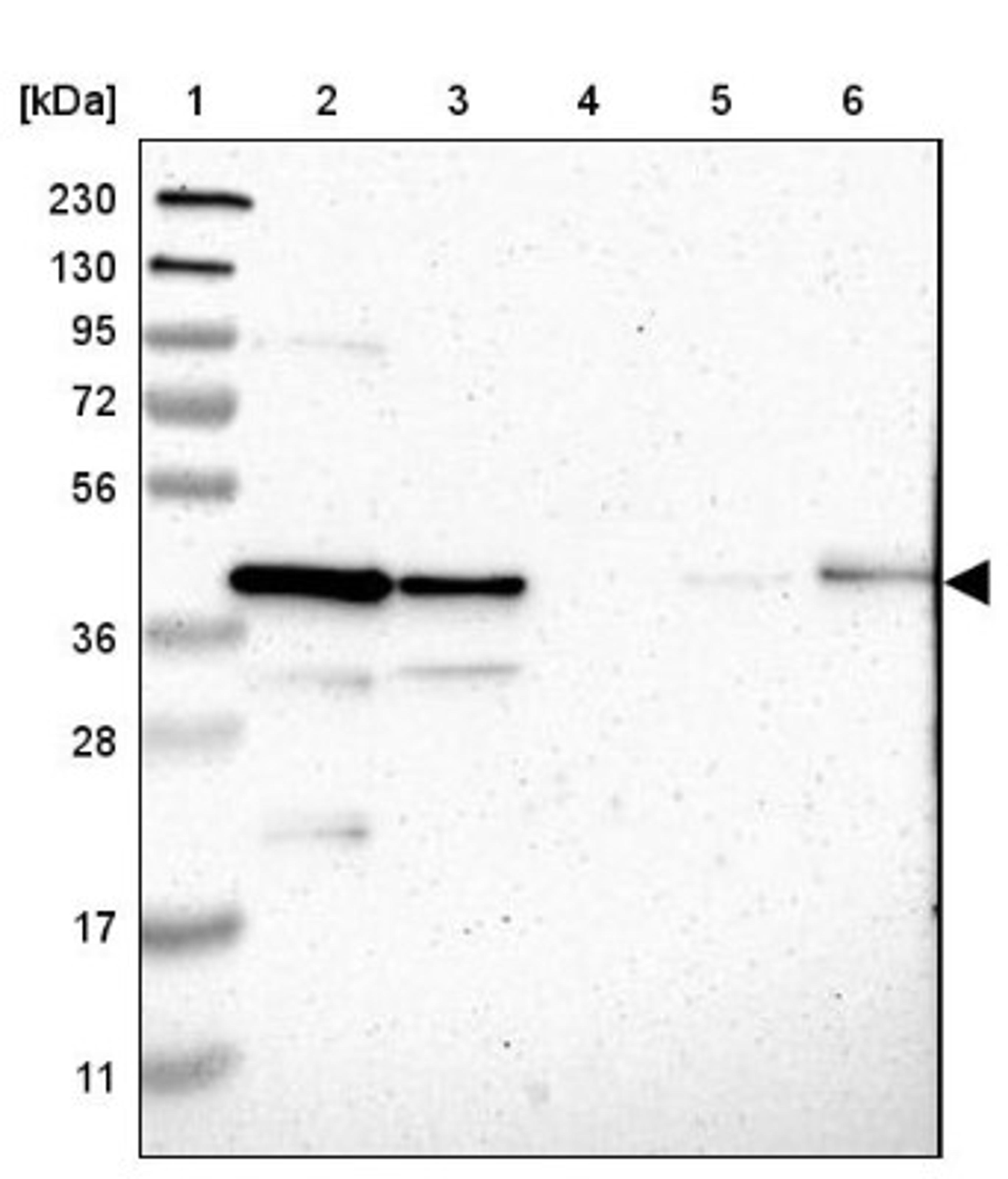 Western Blot: Genethonin 1 Antibody [NBP1-91935] - Lane 1: Marker [kDa] 230, 130, 95, 72, 56, 36, 28, 17, 11<br/>Lane 2: Human cell line RT-4<br/>Lane 3: Human cell line U-251MG sp<br/>Lane 4: Human plasma (IgG/HSA depleted)<br/>Lane 5: Human liver tissue<br/>Lane 6: Human tonsil tissue