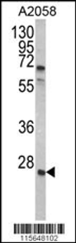 Western blot analysis of GRB2 Antibody in A2058 cell line lysates (35ug/lane)