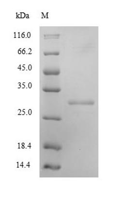 (Tris-Glycine gel) Discontinuous SDS-PAGE (reduced) with 5% enrichment gel and 15% separation gel.
