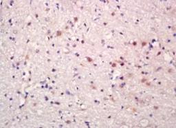 Immunohistochemical analysis of formalin-fixed paraffin embedded rat brain tissue using BEND3 antibody (dilution at 1:200)