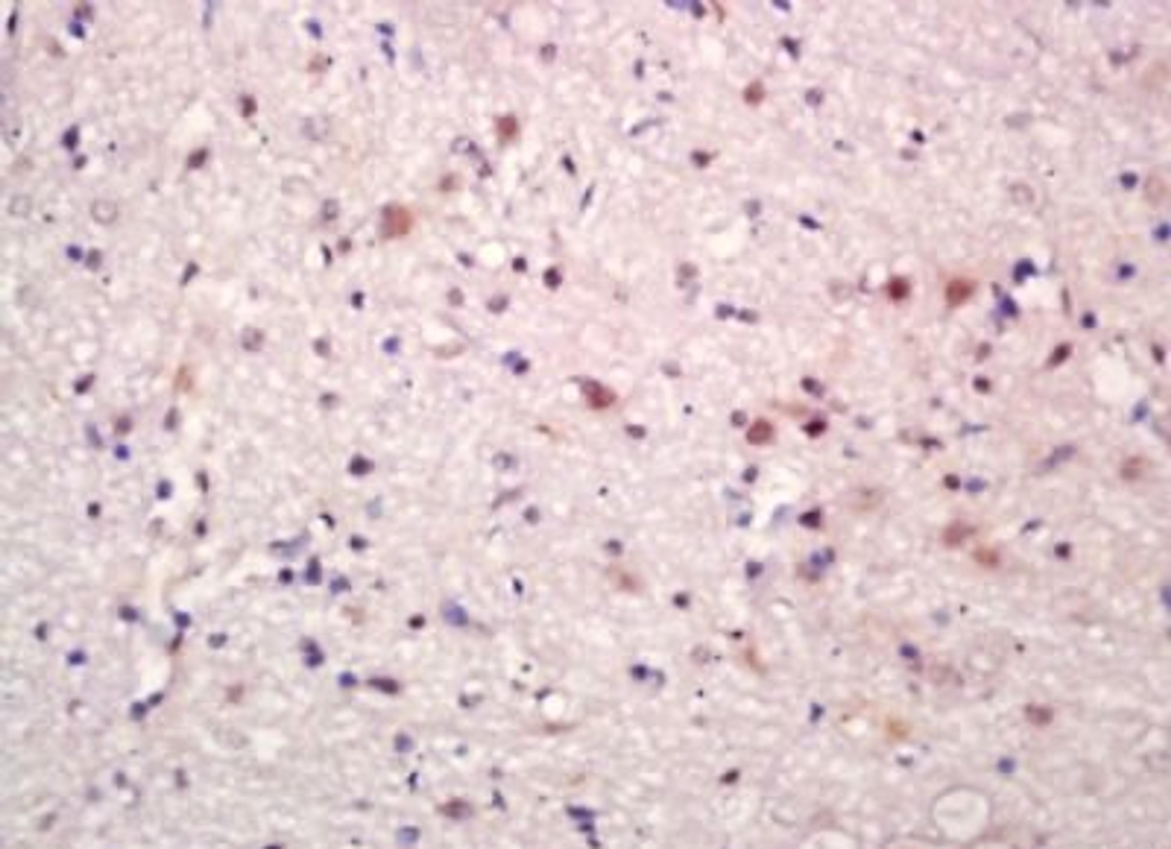 Immunohistochemical analysis of formalin-fixed paraffin embedded rat brain tissue using BEND3 antibody (dilution at 1:200)