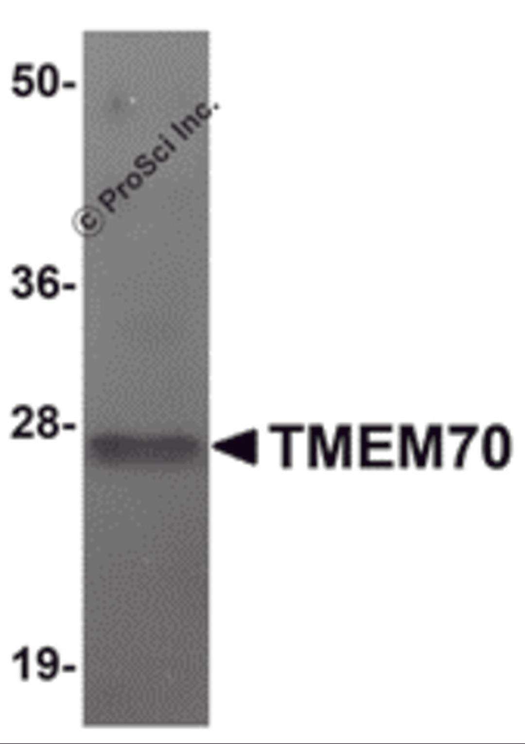 Western blot analysis of TMEM70 in human liver tissue lysate with TMEM70 antibody at 1 μg/mL.
