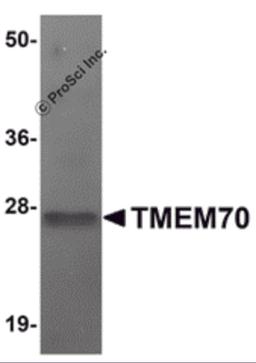 Western blot analysis of TMEM70 in human liver tissue lysate with TMEM70 antibody at 1 μg/mL.