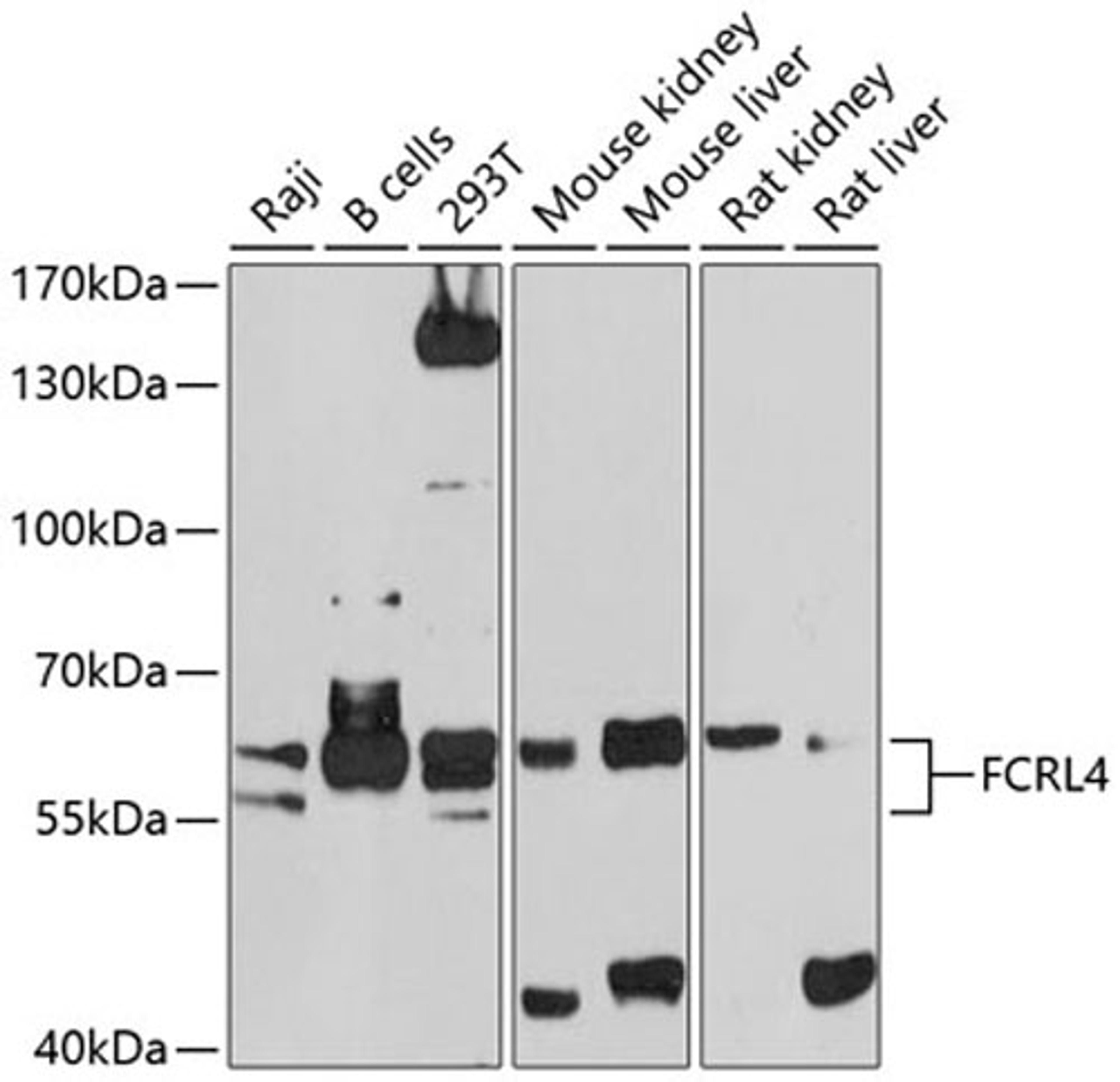 Western blot - FCRL4 antibody (A10329)