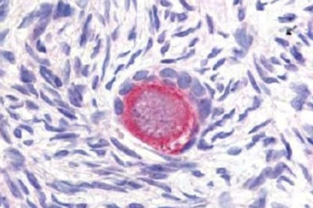 Immunohistochemistry-Paraffin: DLL4 Antibody [NB600-892] - This antibody was used at 20ug/mL in a variety of tissues including colon, liver, skeletal muscle, ovary, pancreas, prostate, testes, thymus, tonsil and uterus. In contrast to reported findings, no staining was observed in vascular tissue. This image shows Delta-4 staining of human ovary.