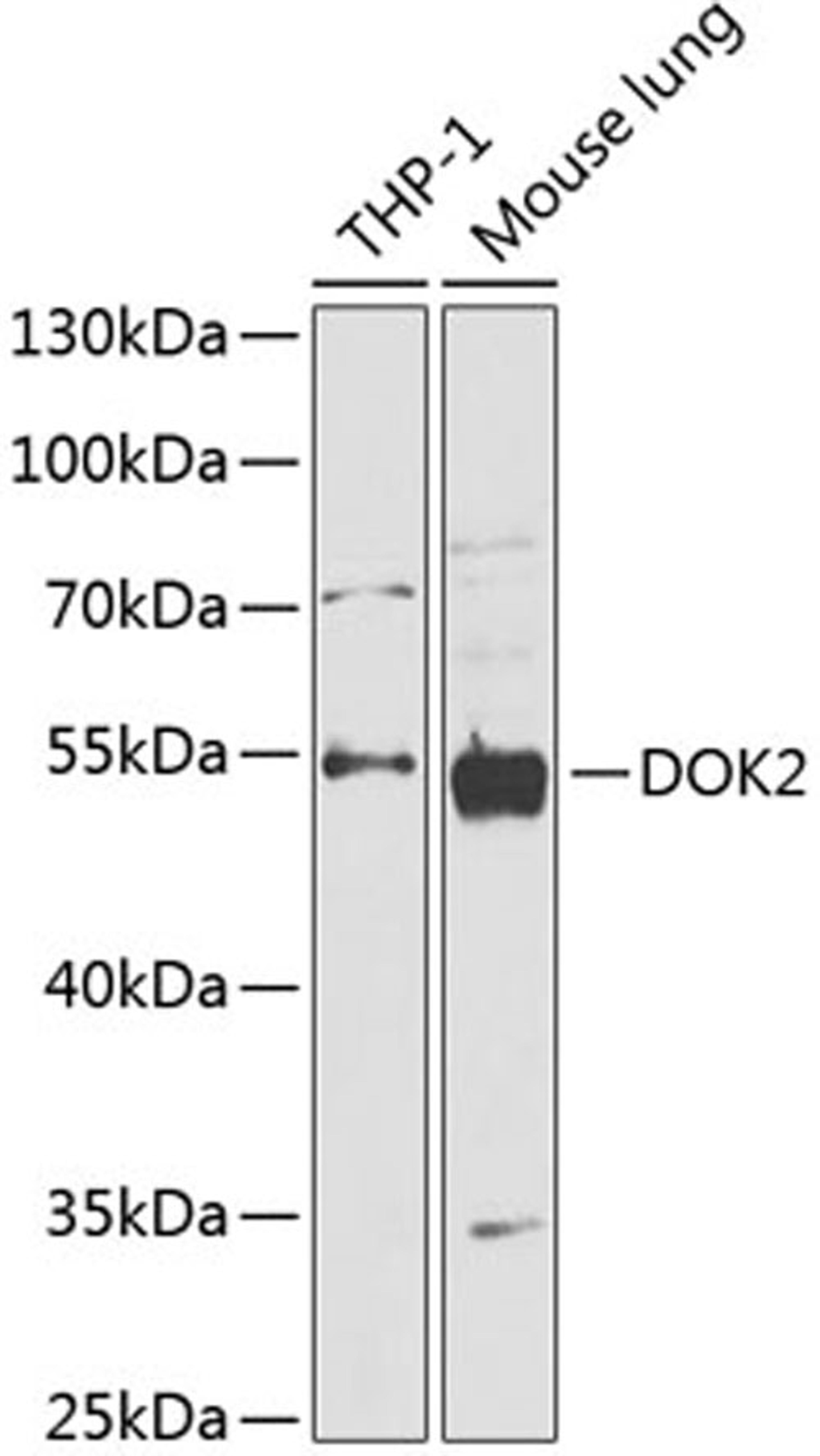 Western blot - DOK2 antibody (A14084)