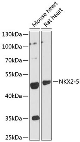 Western blot - NKX2-5 antibody (A12688)