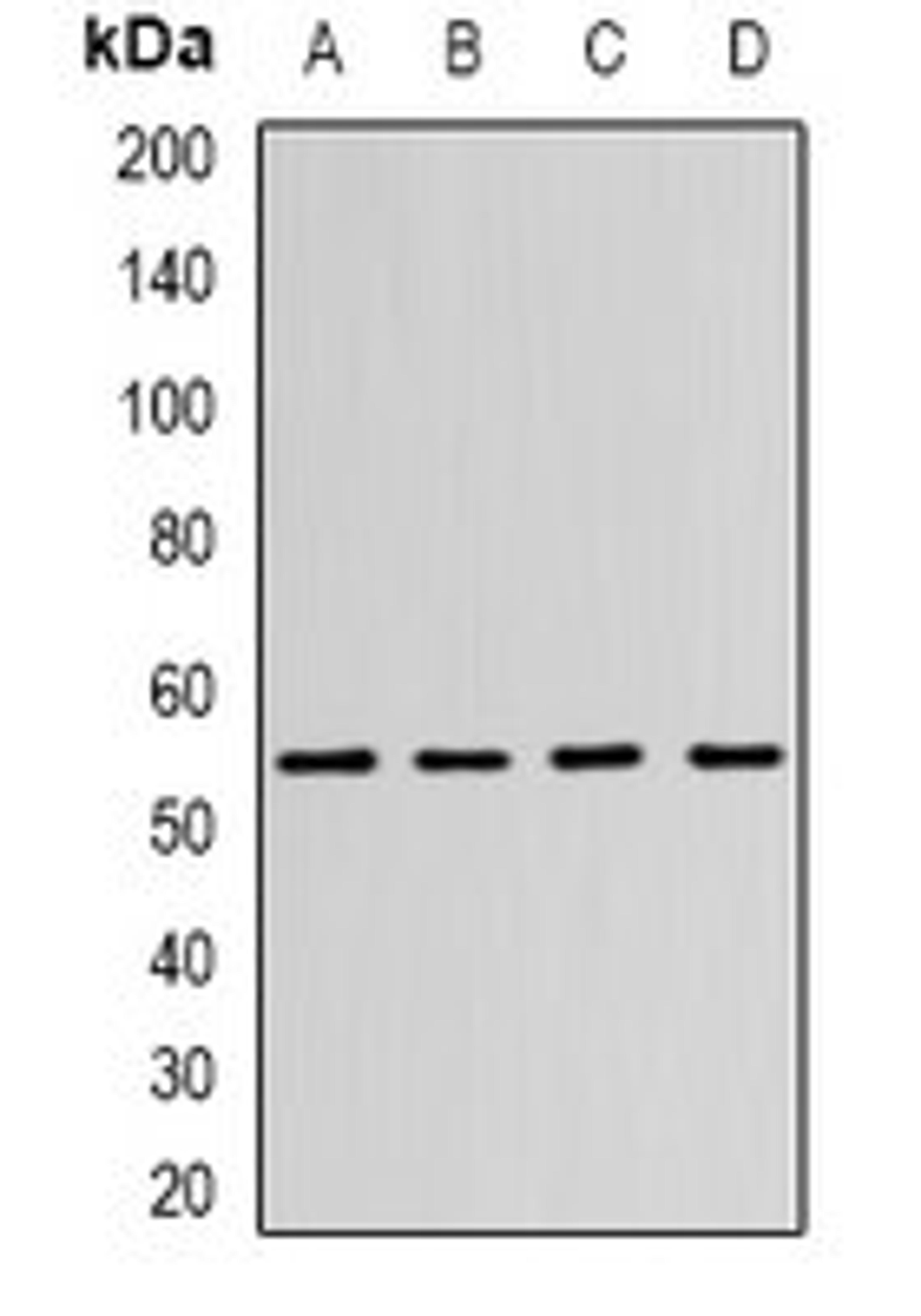 Western blot analysis of SW480 (Lane1), MCF7 (Lane2), mouse brain (Lane3), mouse kidney (Lane4) whole cell lysates using WASL antibody