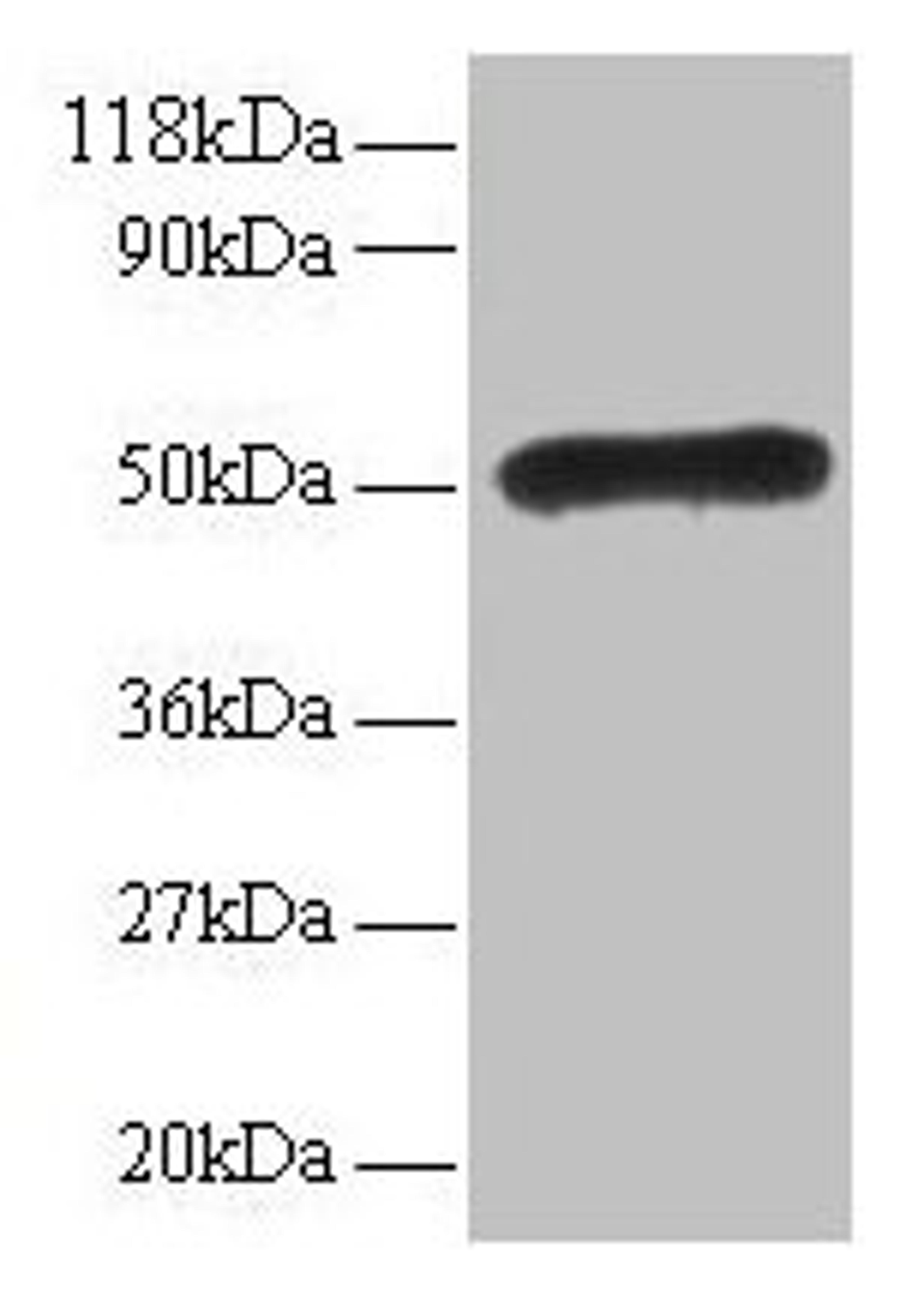 Western blot. All lanes: LMO1 antibody at 2µg/ml. Lane 1: EC109 whole cell lysate. Lane 2: 293T whole cell lysate. Secondary. Goat polyclonal to rabbit IgG at 1/15000 dilution. Predicted band size: 18 kDa. Observed band size: 50 kDa
