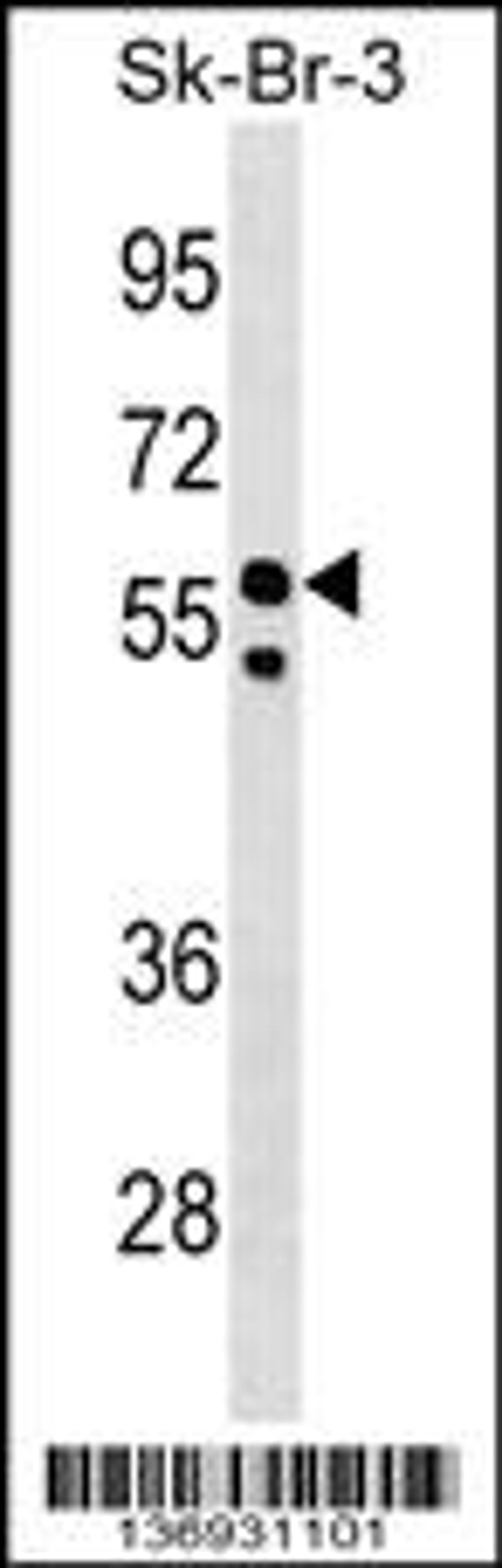 Western blot analysis in SK-BR-3 cell line lysates (35ug/lane).