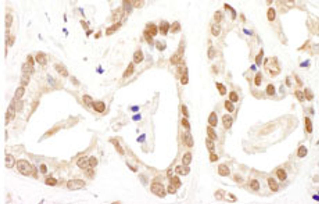 Detection of human FANCD2 by immunohistochemistry.