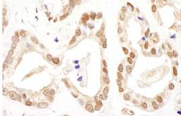 Detection of human FANCD2 by immunohistochemistry.