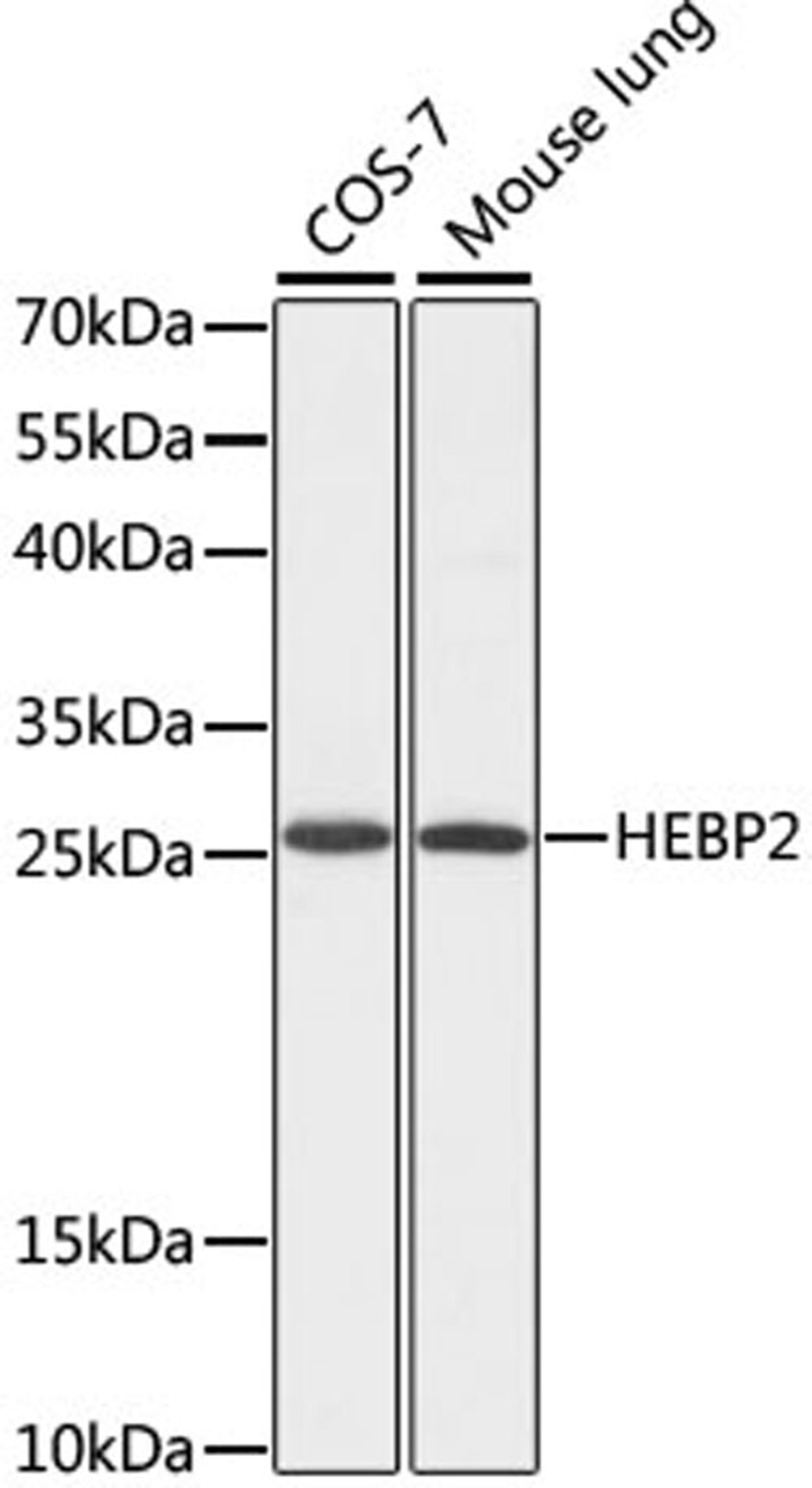 Western blot - HEBP2 antibody (A16504)