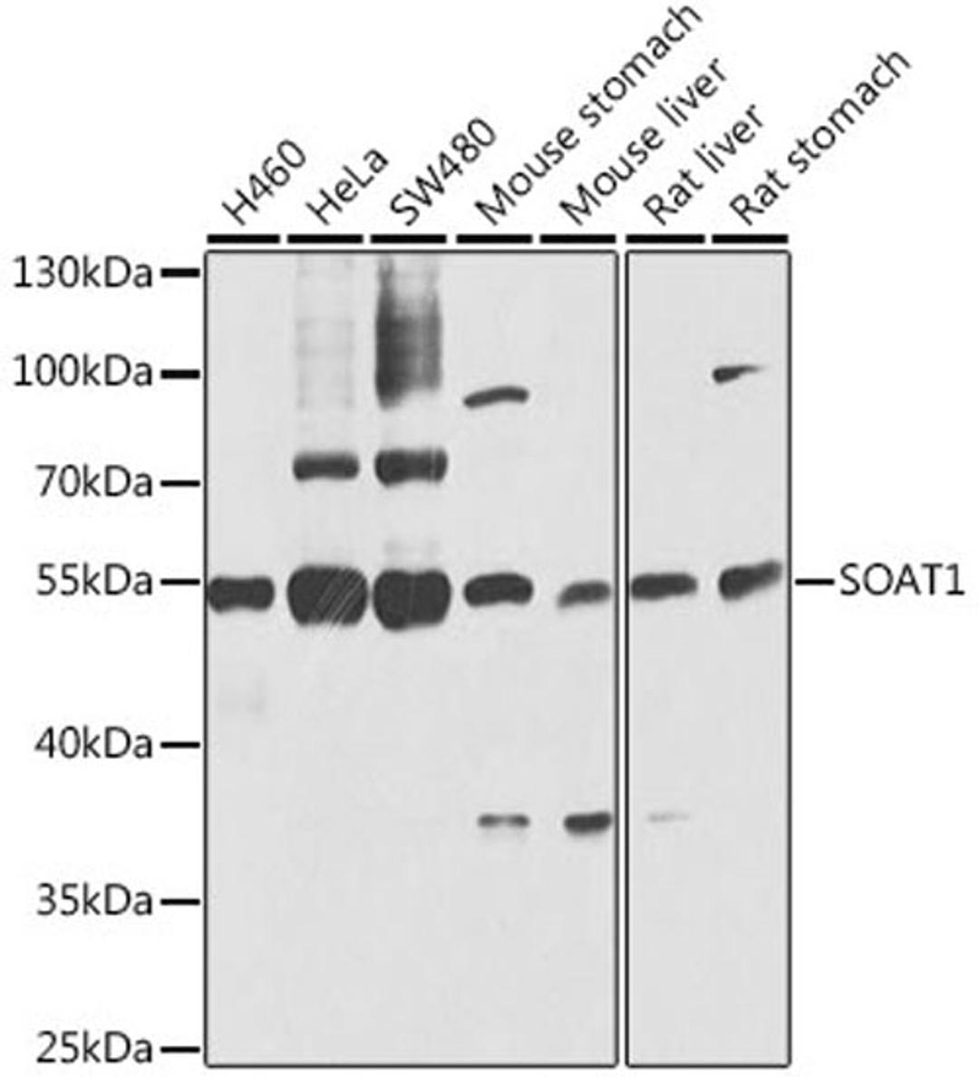 Western blot - SOAT1 antibody (A6311)