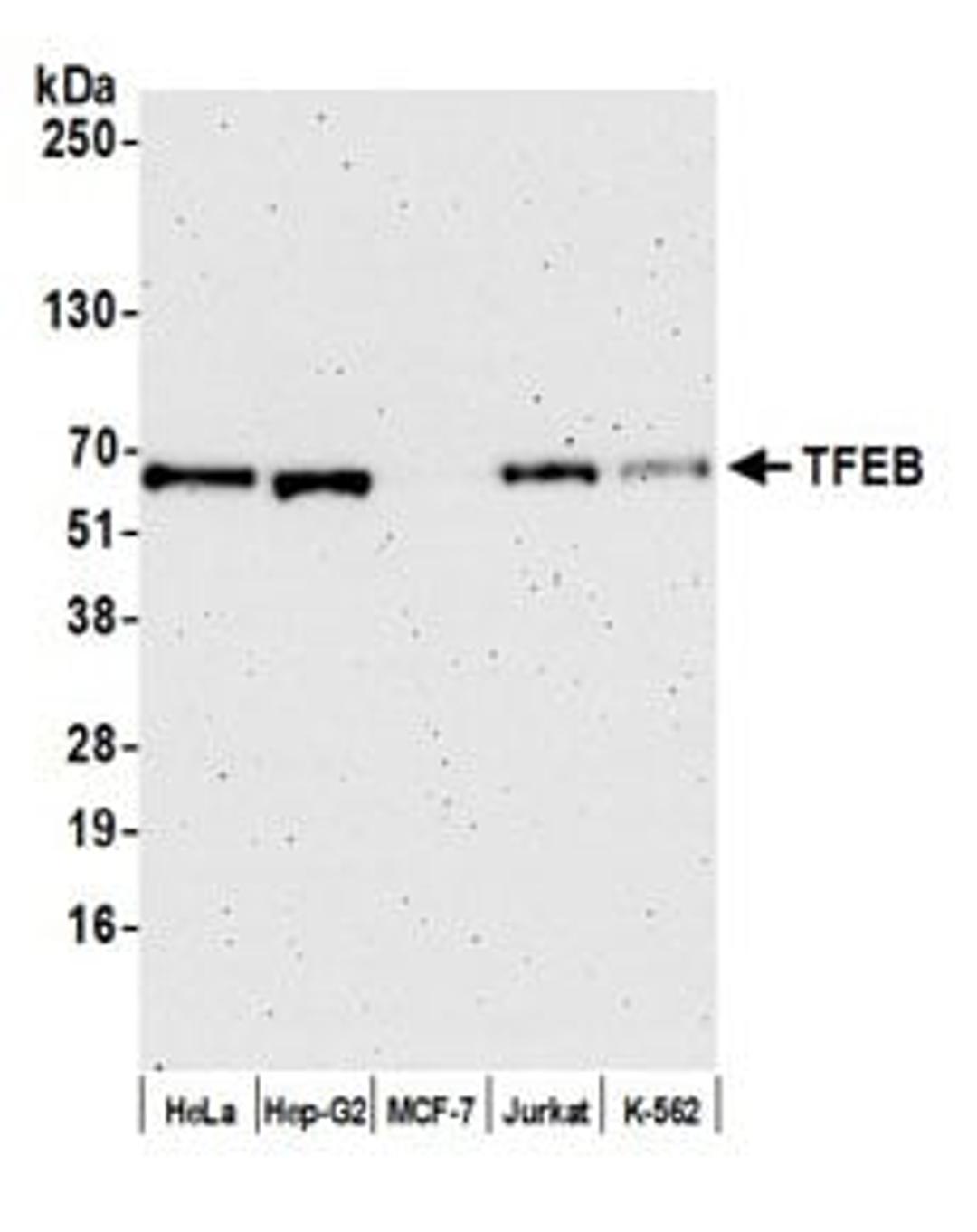 Detection of human TFEB by western blot.