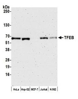 Detection of human TFEB by western blot.