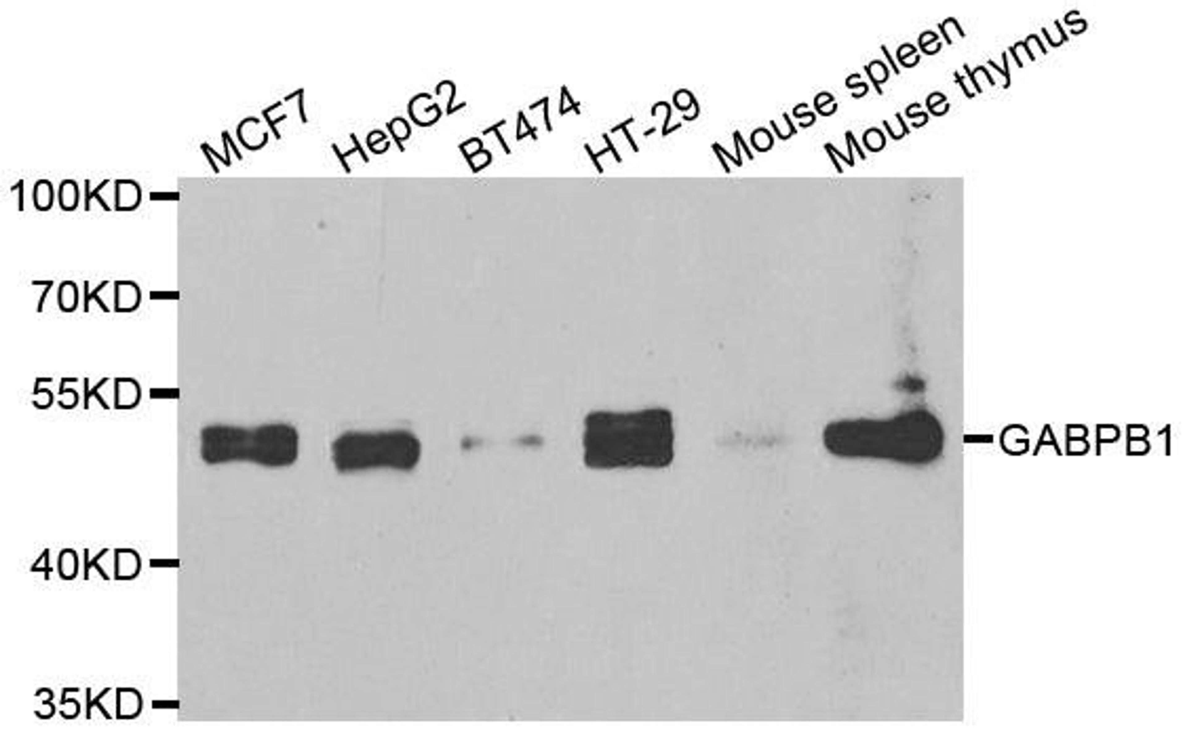 Western blot analysis of extracts of various cell lines using GABPB1 antibody