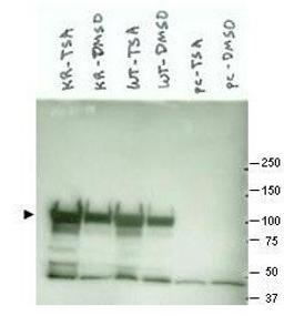 Western blot analysis of various lysate preparations (arrowhead). Cos7 transfected with mutant K294R Hsp90 (left two lanes), Cos7 transfected with wild type Hsp90 (middle two lanes) and empty vector Cos7 cells (right two lanes) using Hsp 90 alpha antibody