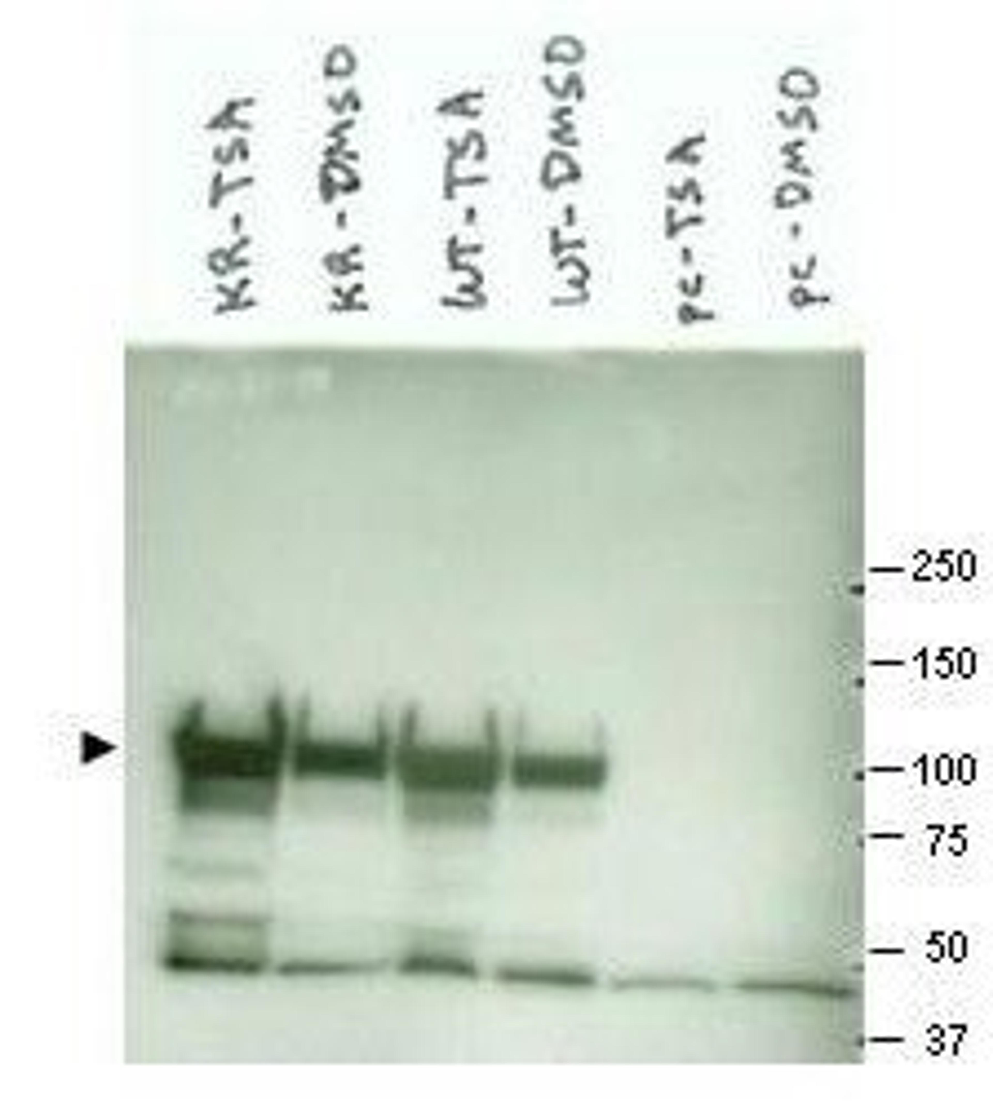 Western blot analysis of various lysate preparations (arrowhead). Cos7 transfected with mutant K294R Hsp90 (left two lanes), Cos7 transfected with wild type Hsp90 (middle two lanes) and empty vector Cos7 cells (right two lanes) using Hsp 90 alpha antibody