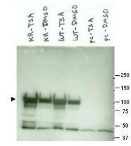 Western blot analysis of various lysate preparations (arrowhead). Cos7 transfected with mutant K294R Hsp90 (left two lanes), Cos7 transfected with wild type Hsp90 (middle two lanes) and empty vector Cos7 cells (right two lanes) using Hsp 90 alpha antibody